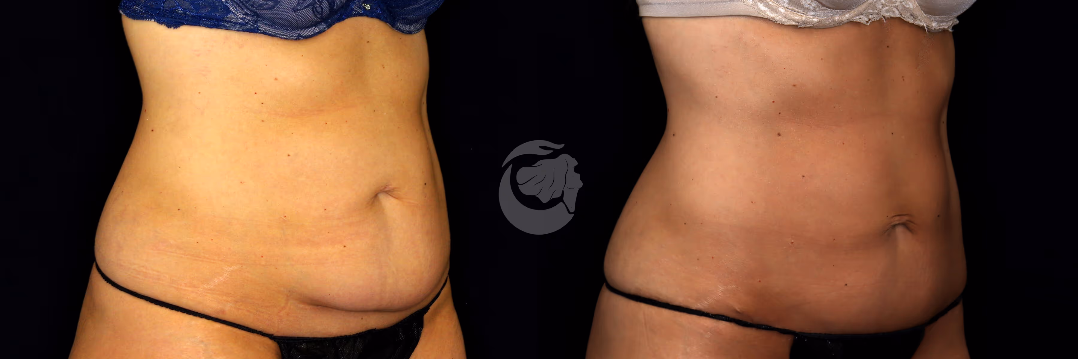 Before And After Patient Image