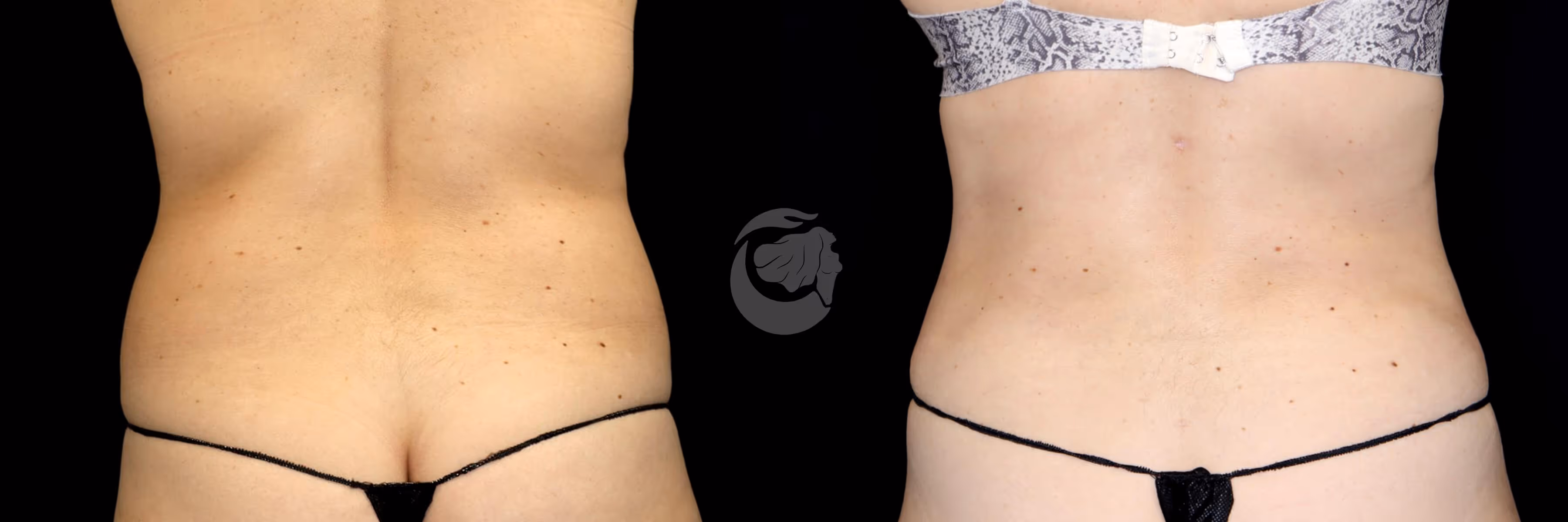 Before And After Patient Image