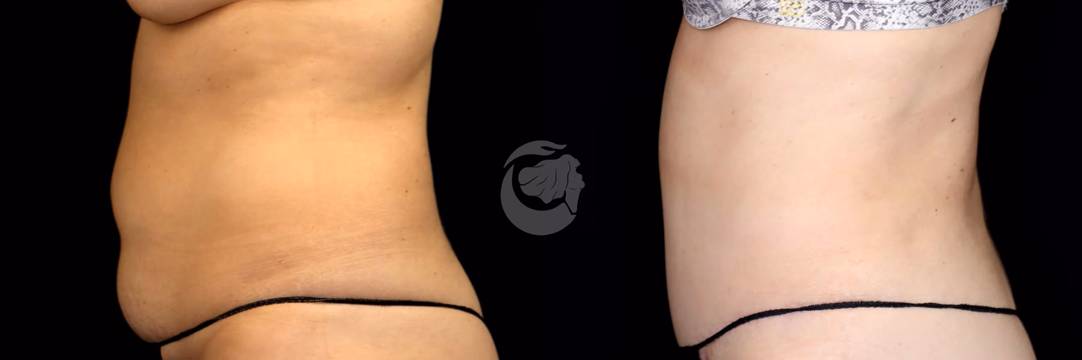 Before And After Patient Image