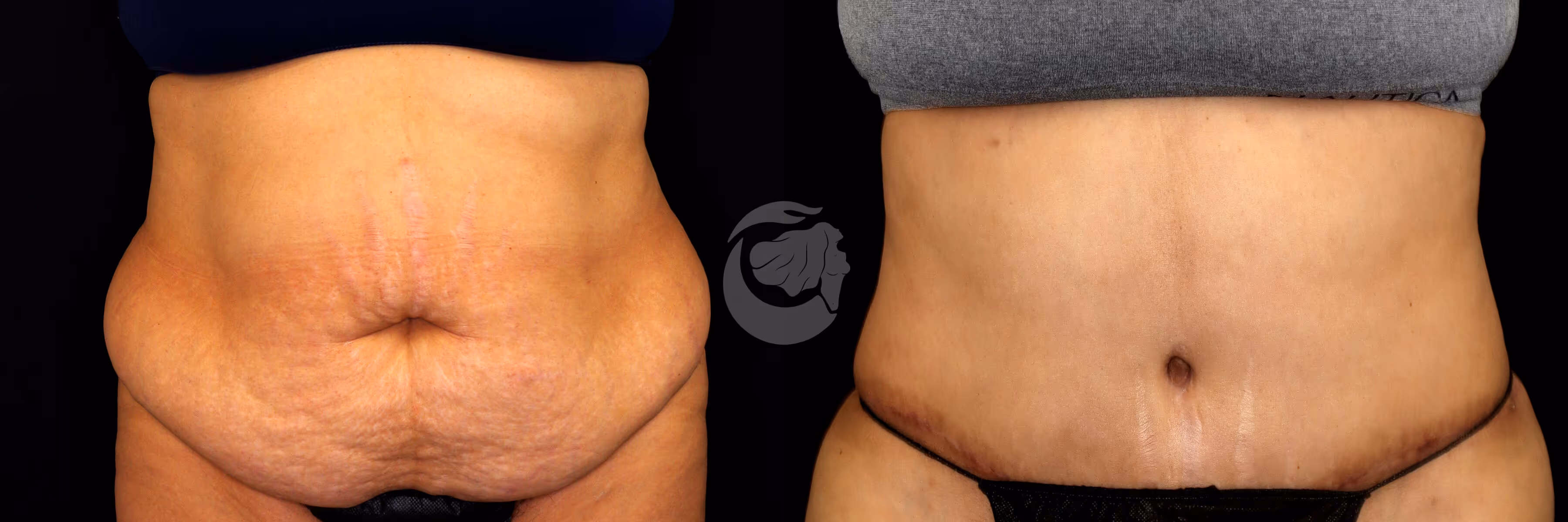Before And After Patient Image