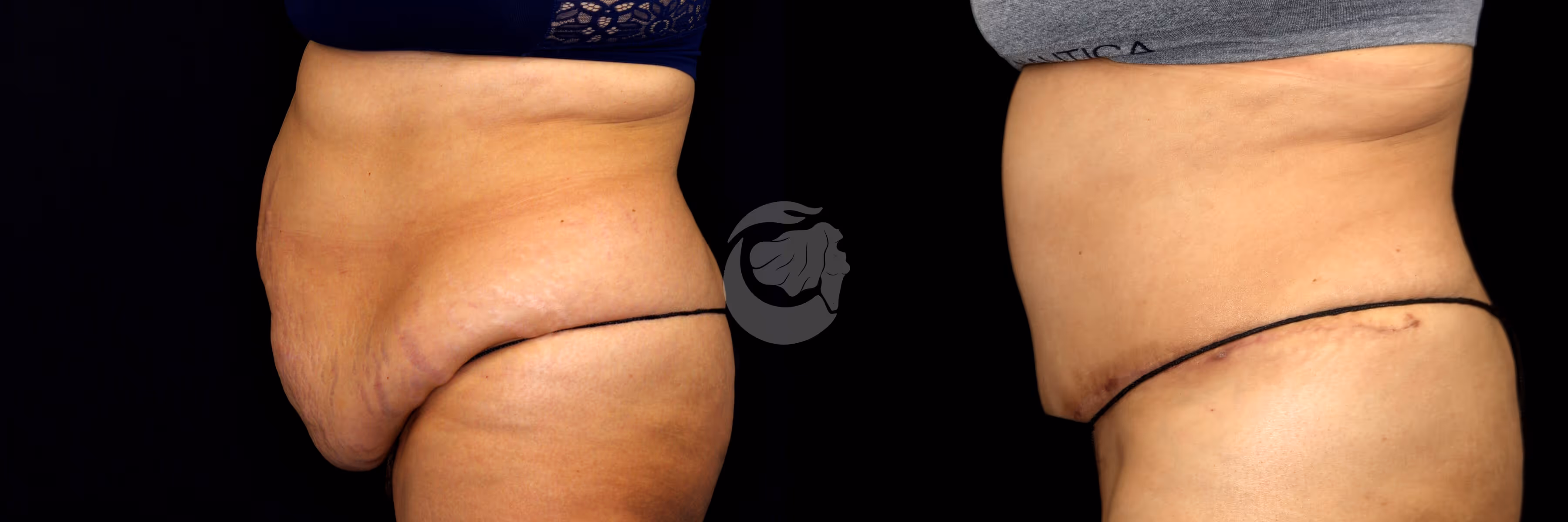 Before And After Patient Image
