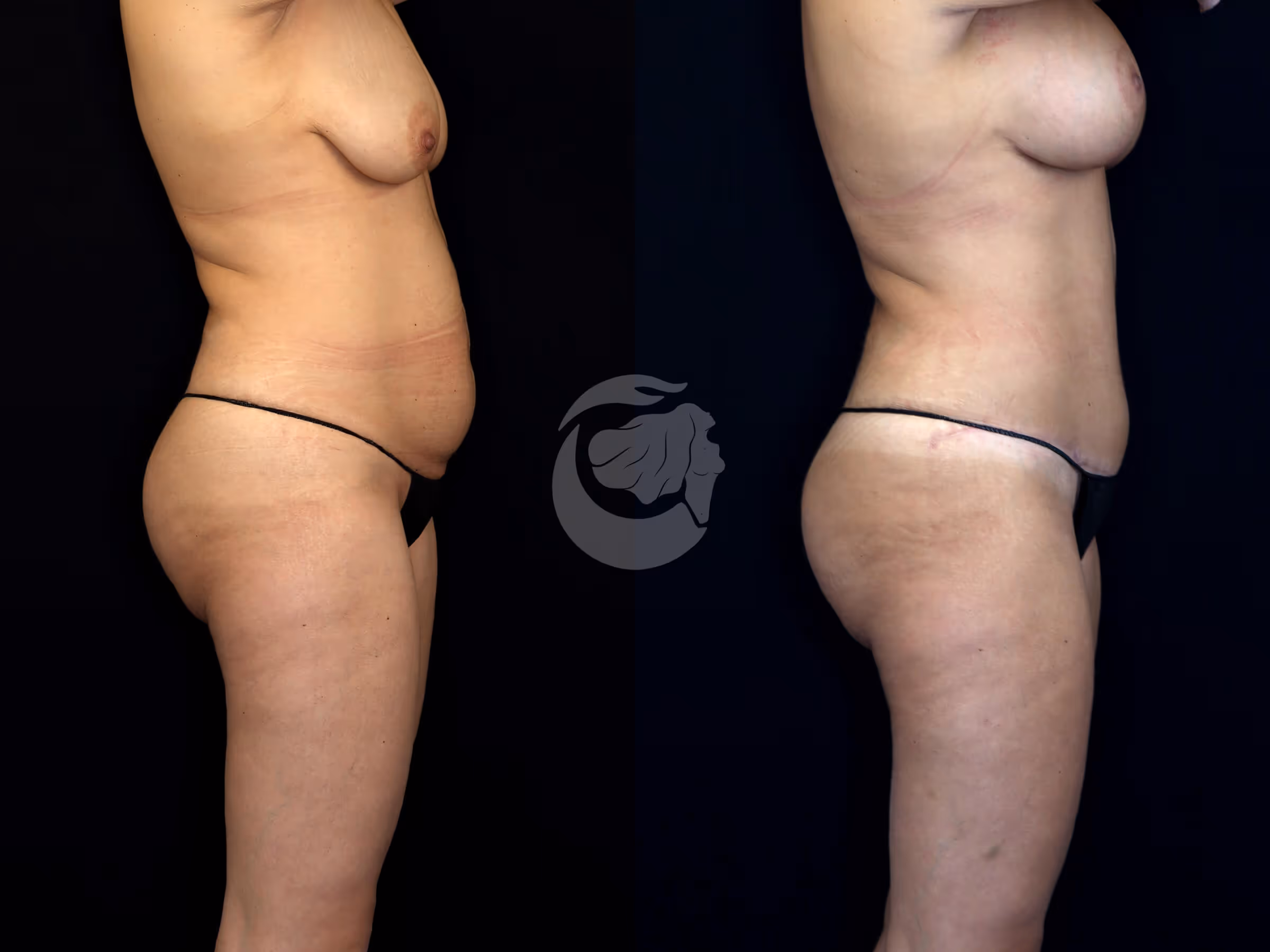 Before And After Patient Image