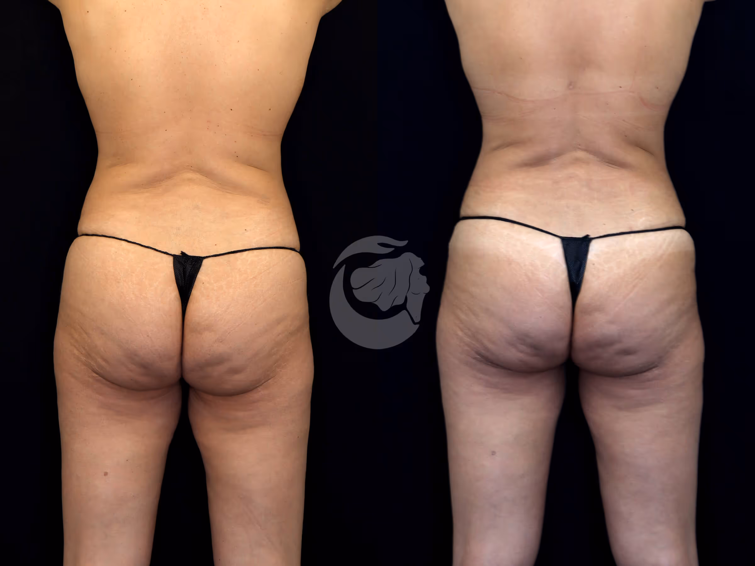 Before And After Patient Image