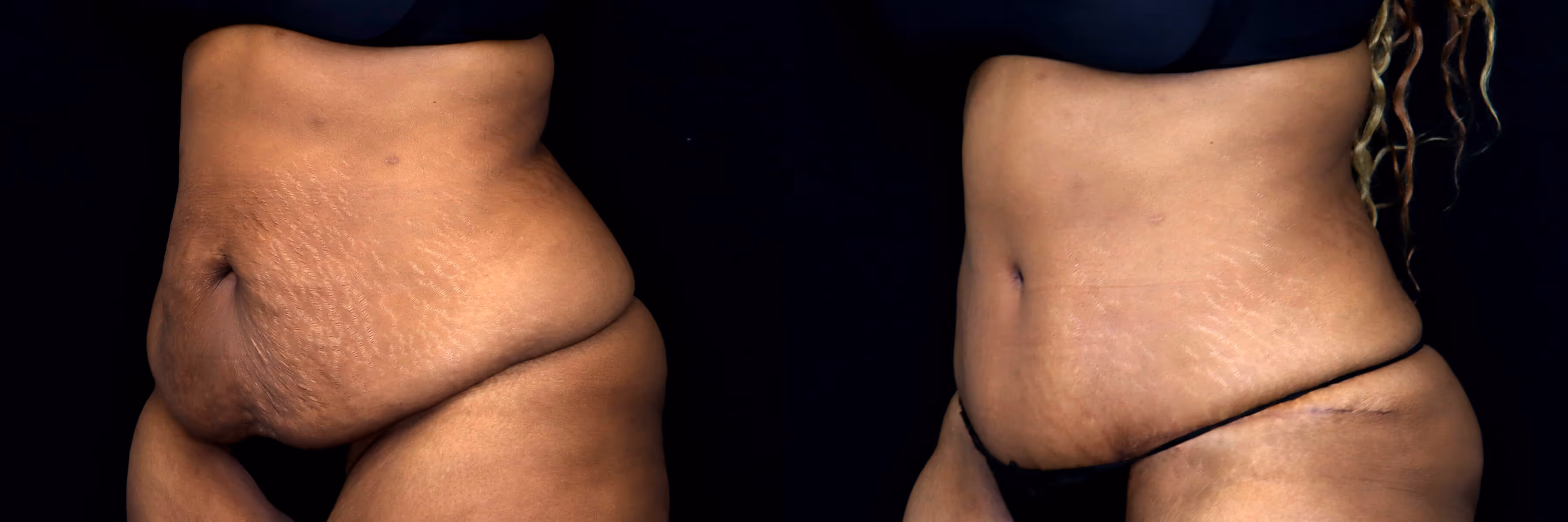 Before And After Patient Image
