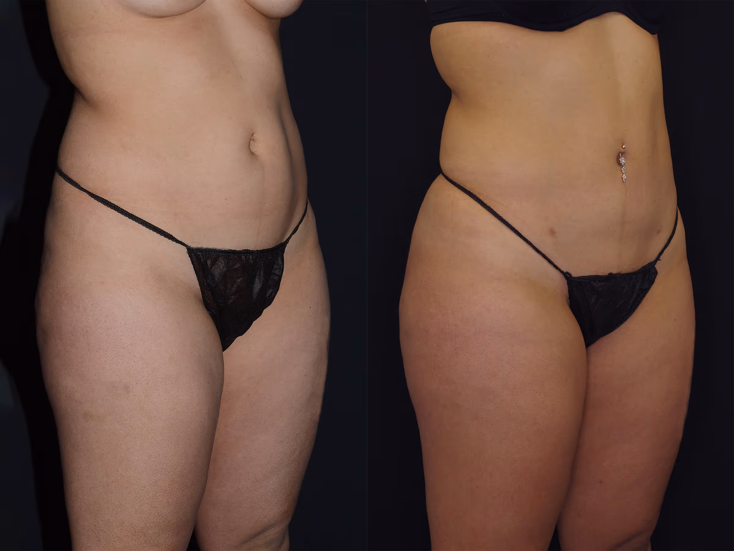 Before And After Patient Image