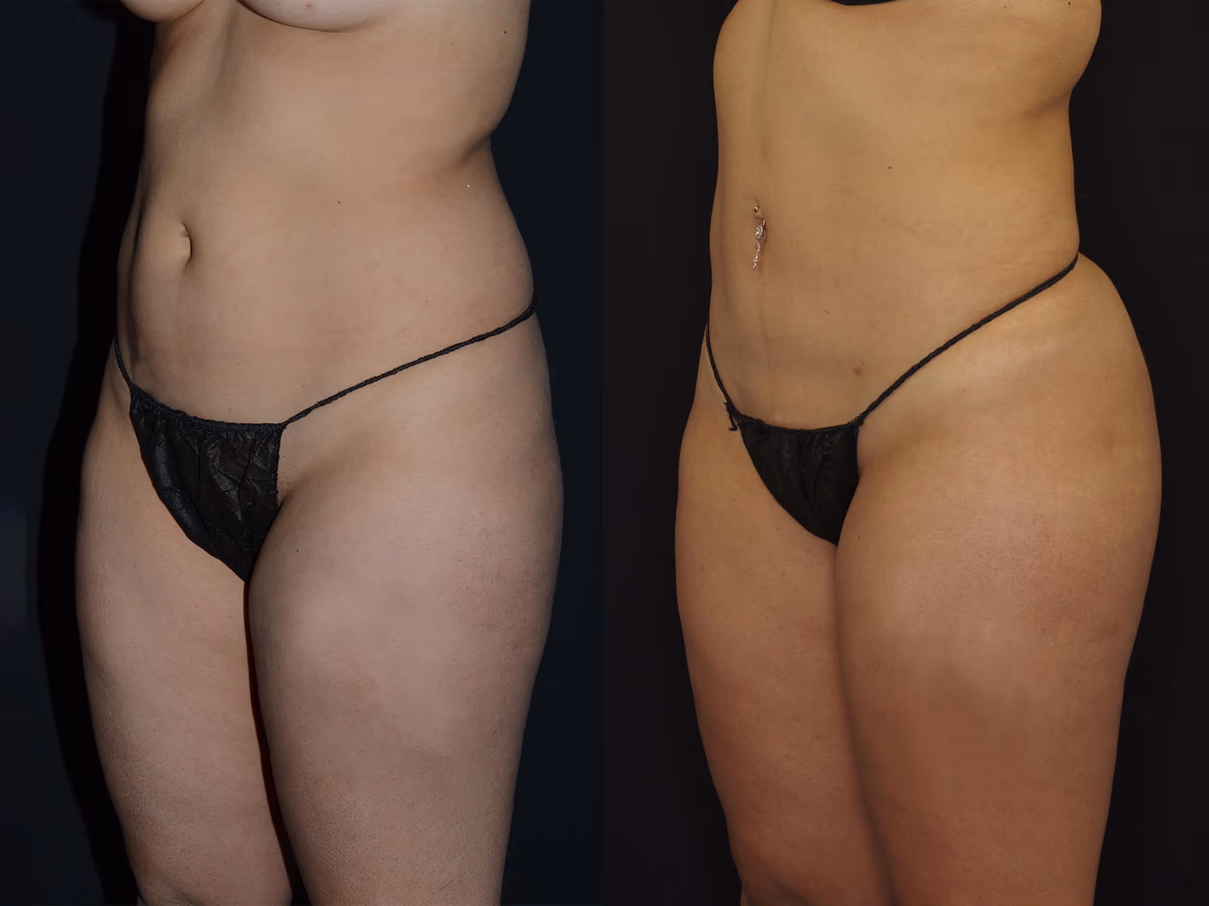 Before And After Patient Image