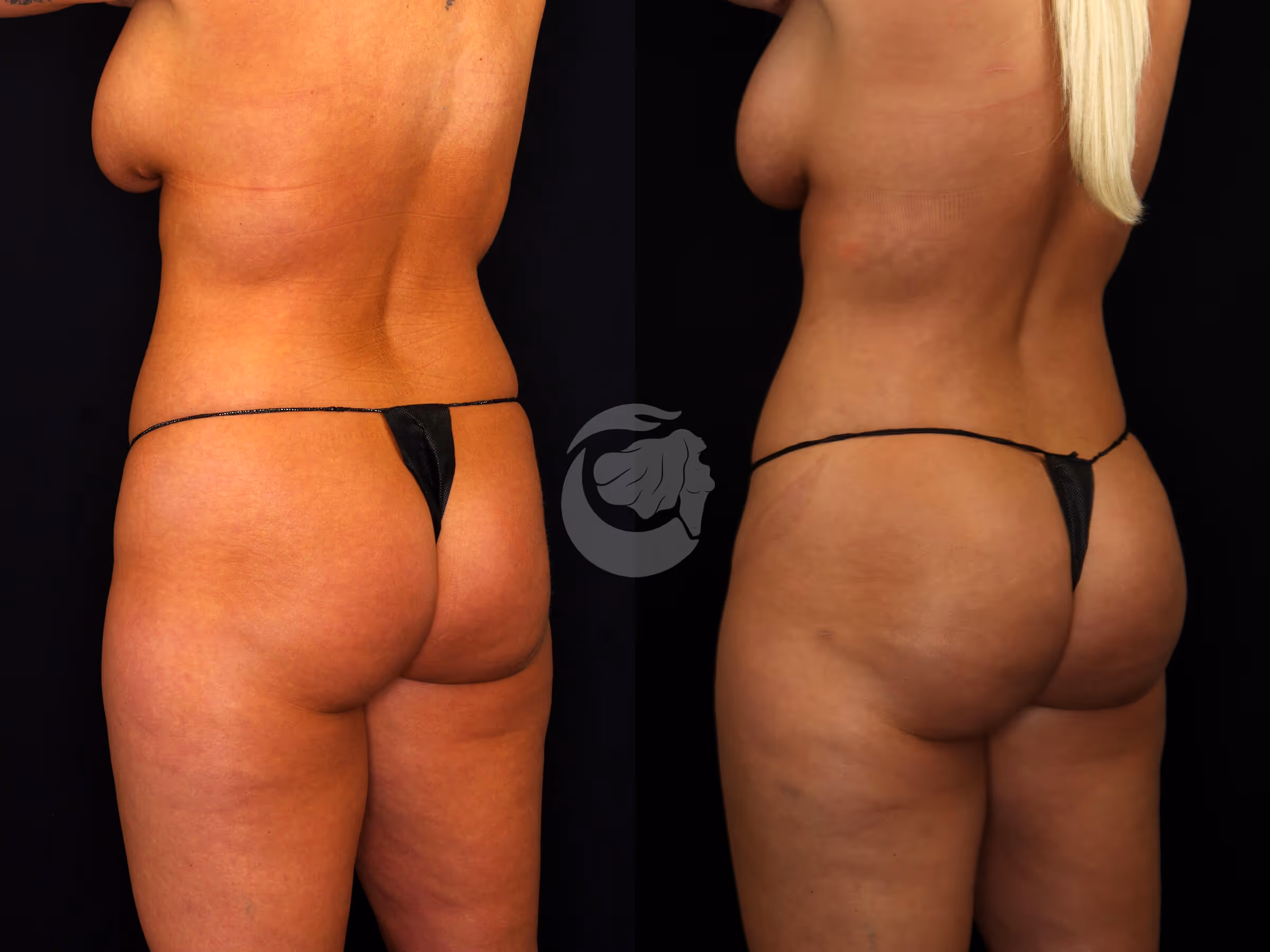 Before And After Patient Image
