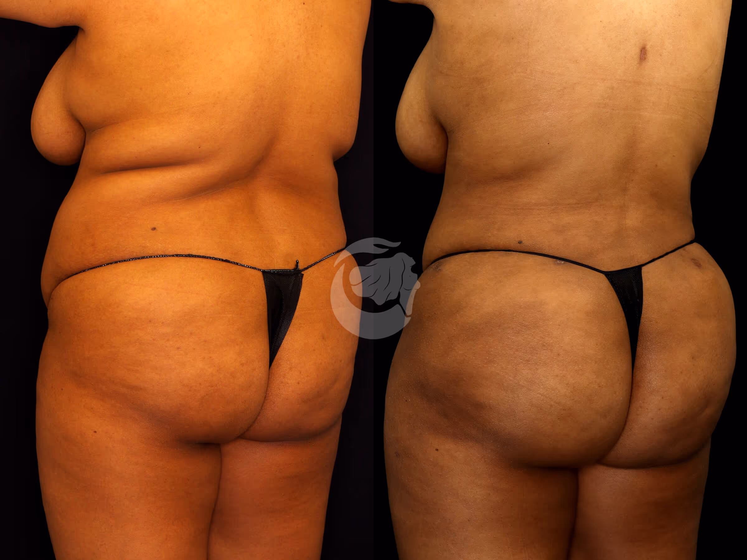 Before And After Patient Image