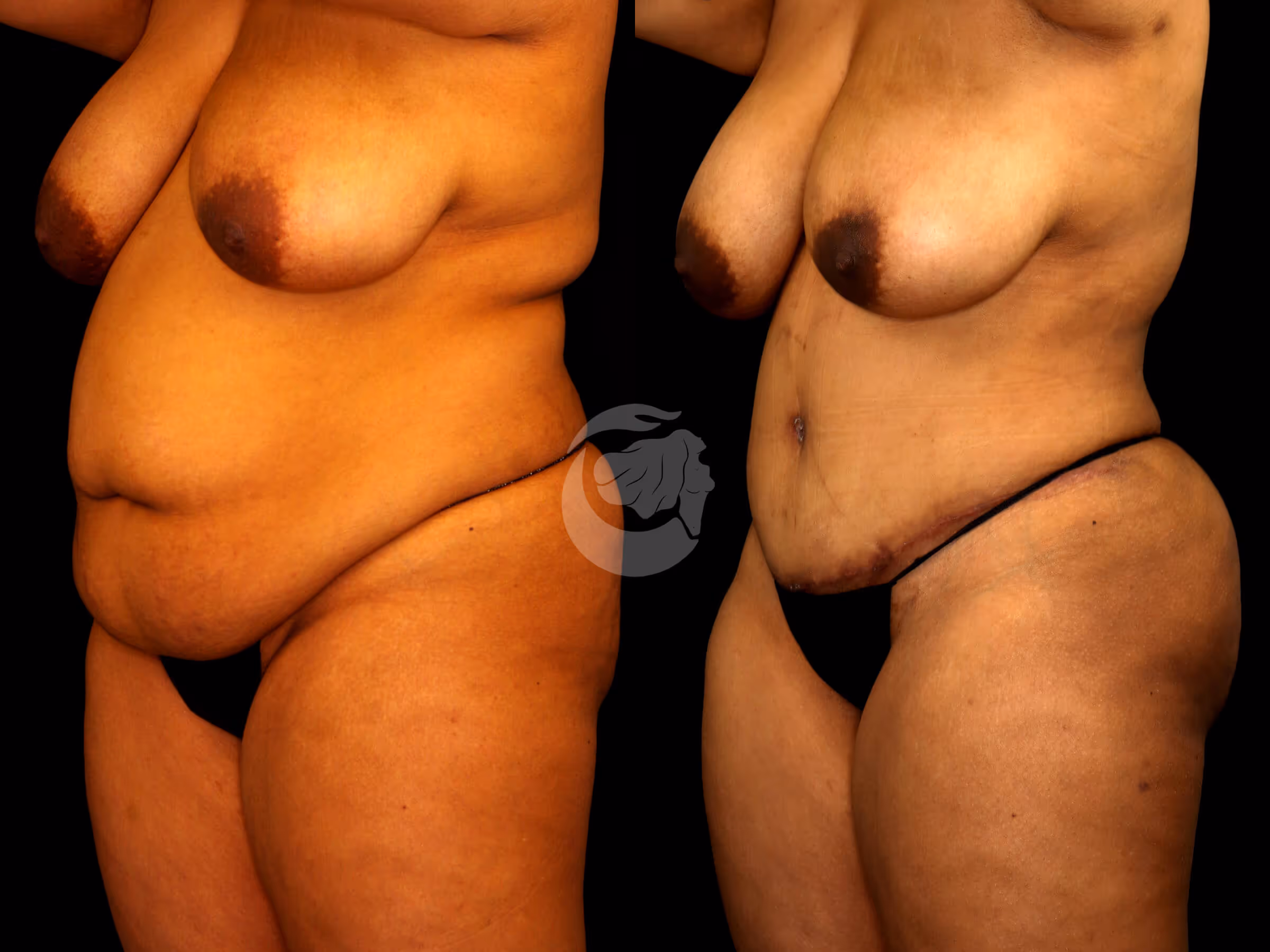 Before And After Patient Image