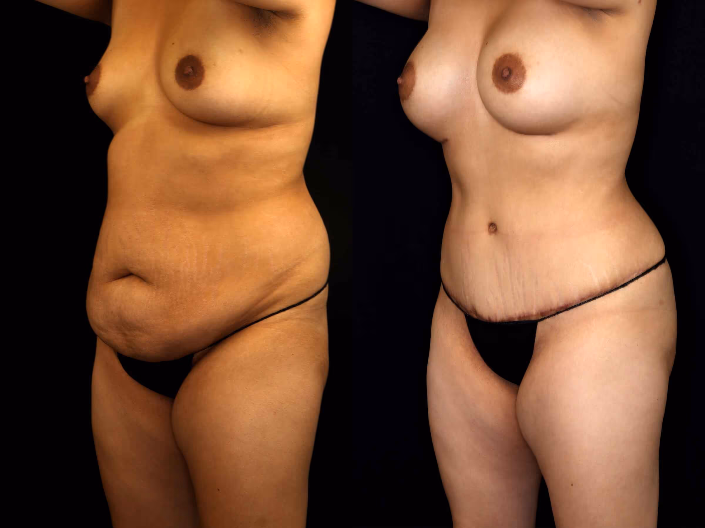 Before And After Patient Image