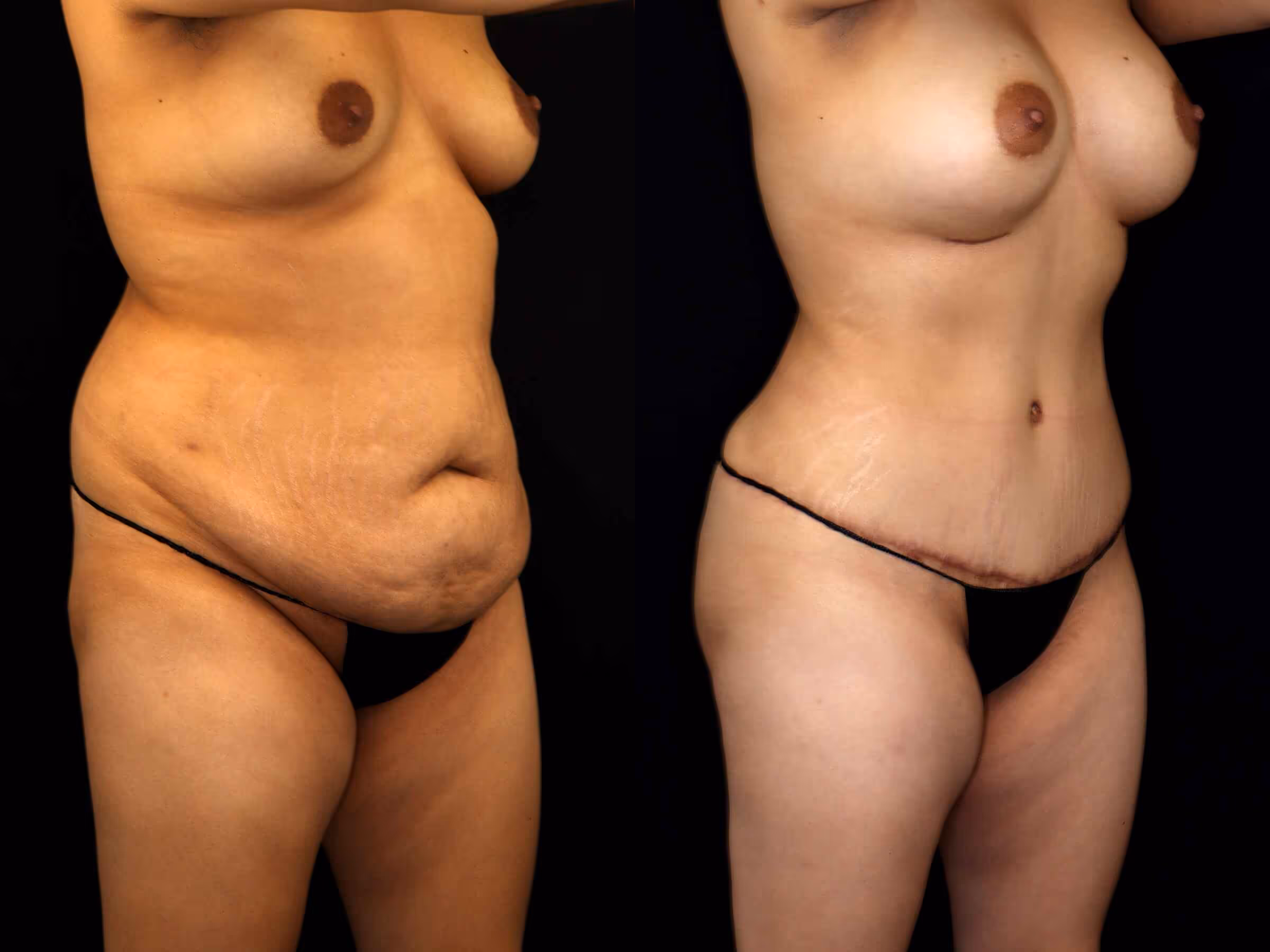 Before And After Patient Image
