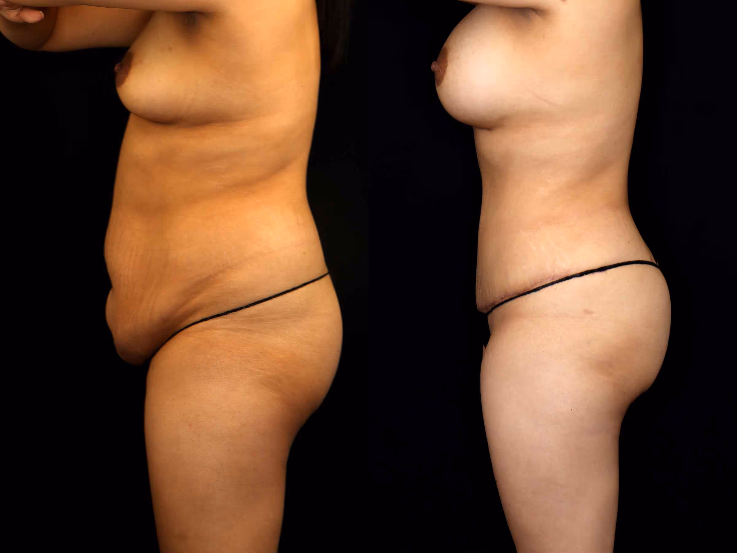 Before And After Patient Image