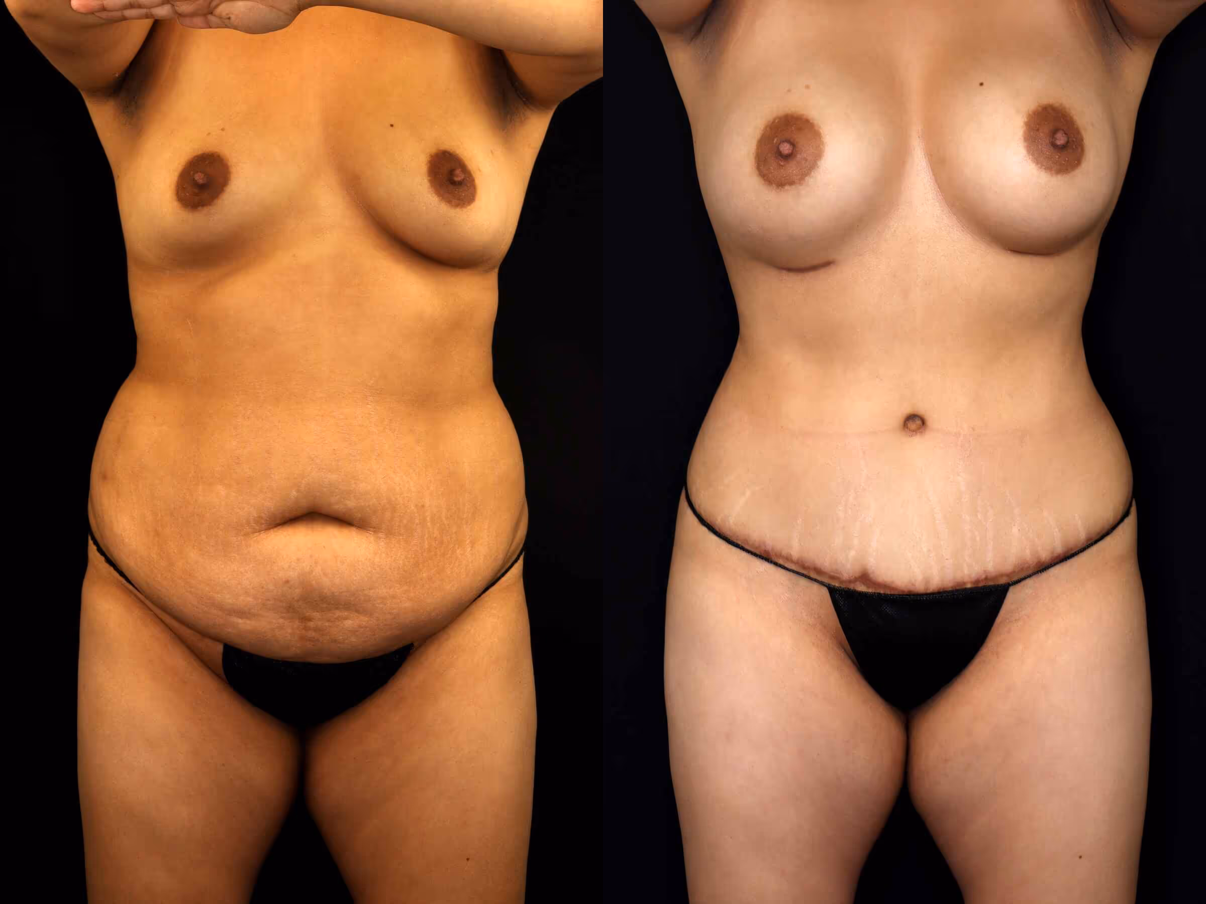 Before And After Patient Image