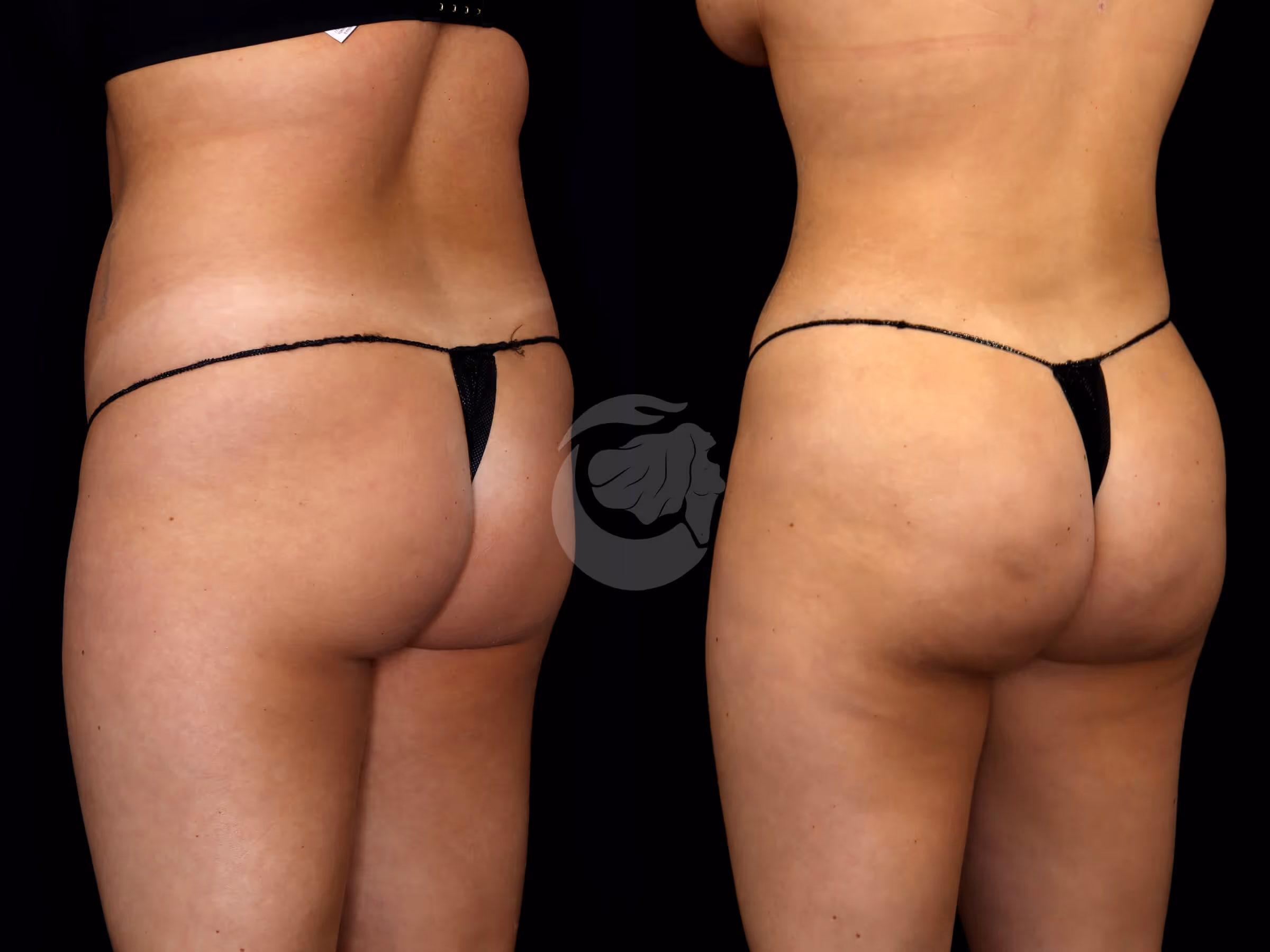 Before And After Patient Image
