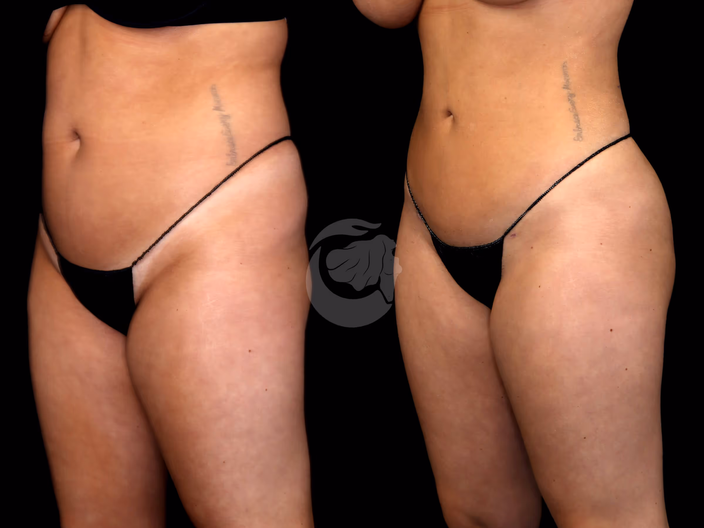 Before And After Patient Image