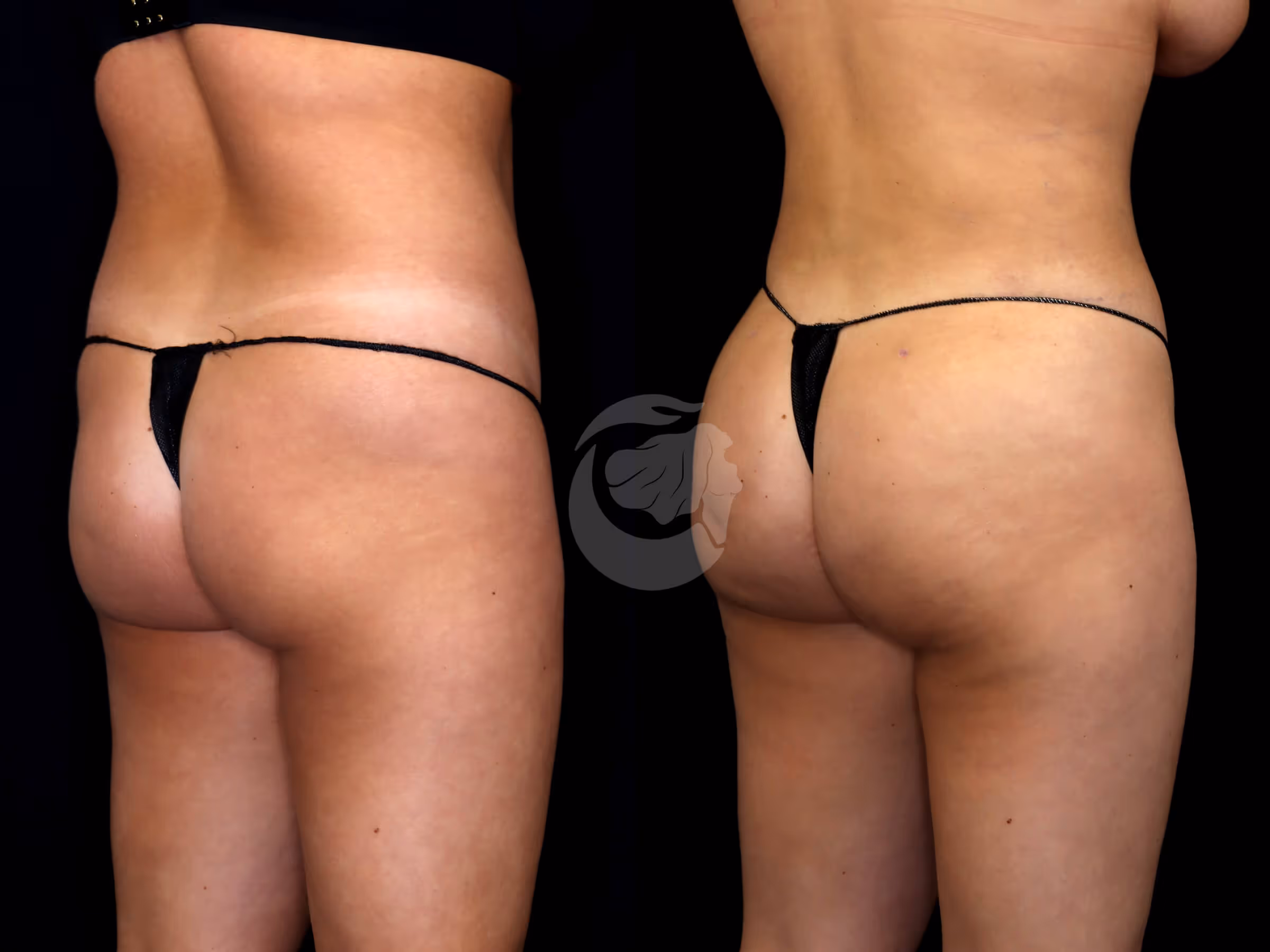 Before And After Patient Image