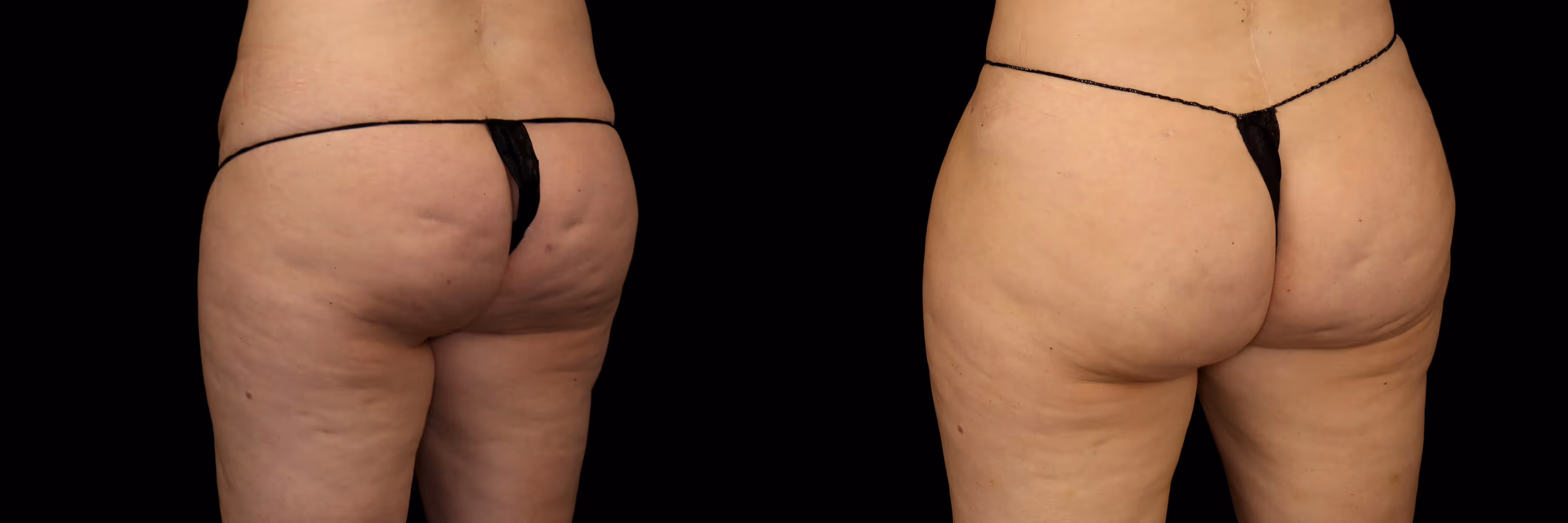 Before And After Patient Image