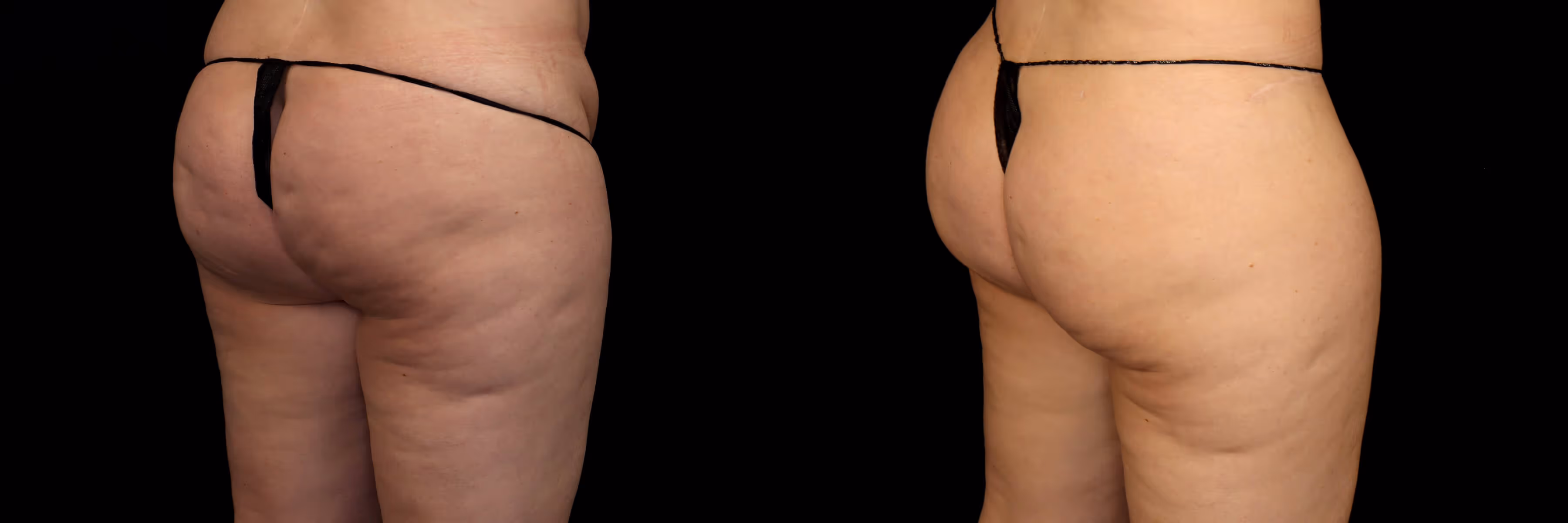 Before And After Patient Image