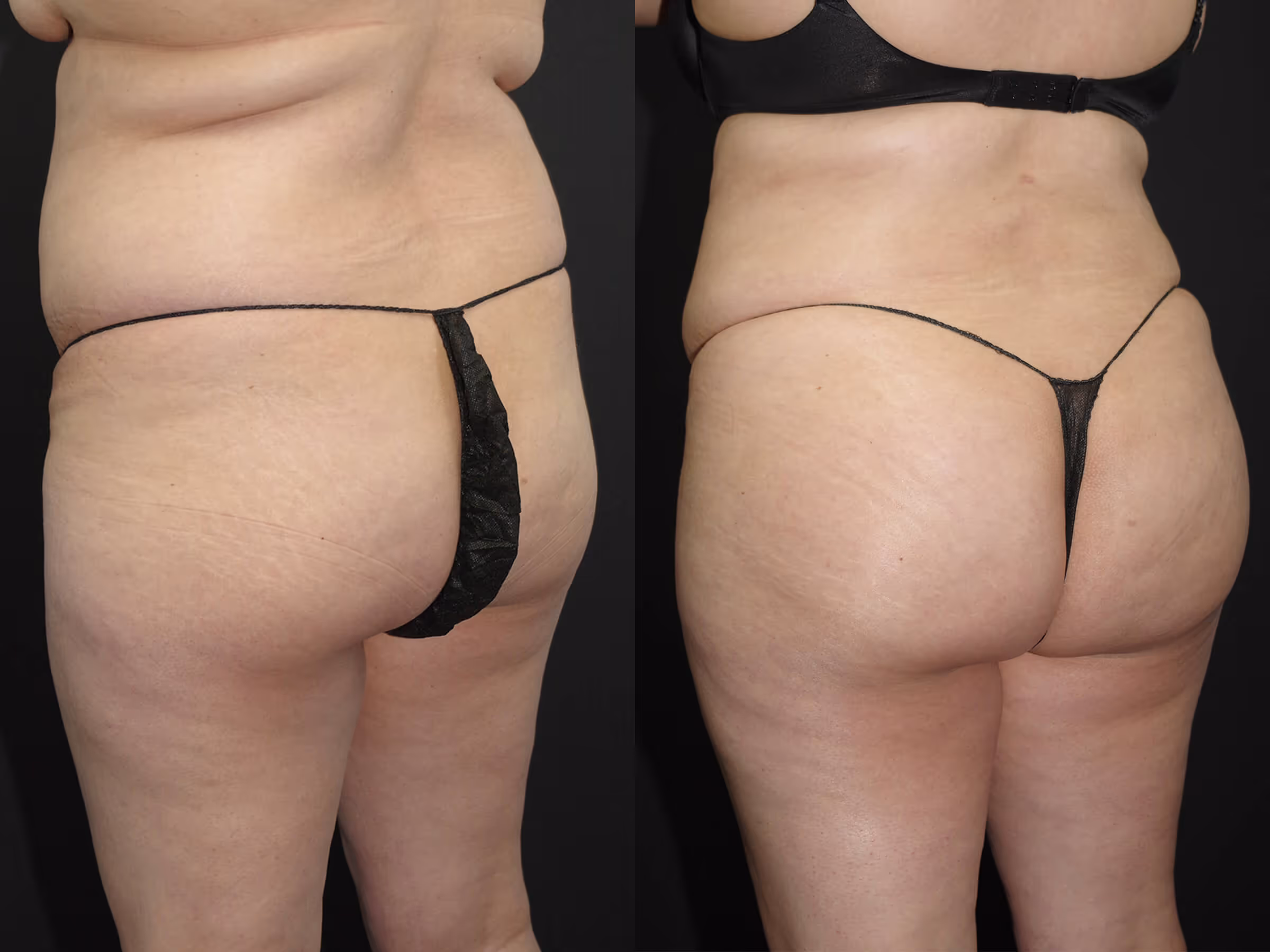 Before And After Patient Image