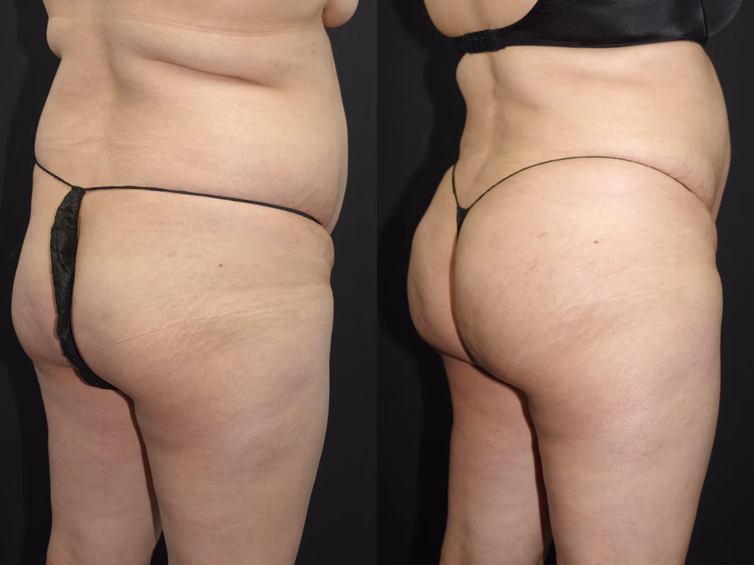 Before And After Patient Image