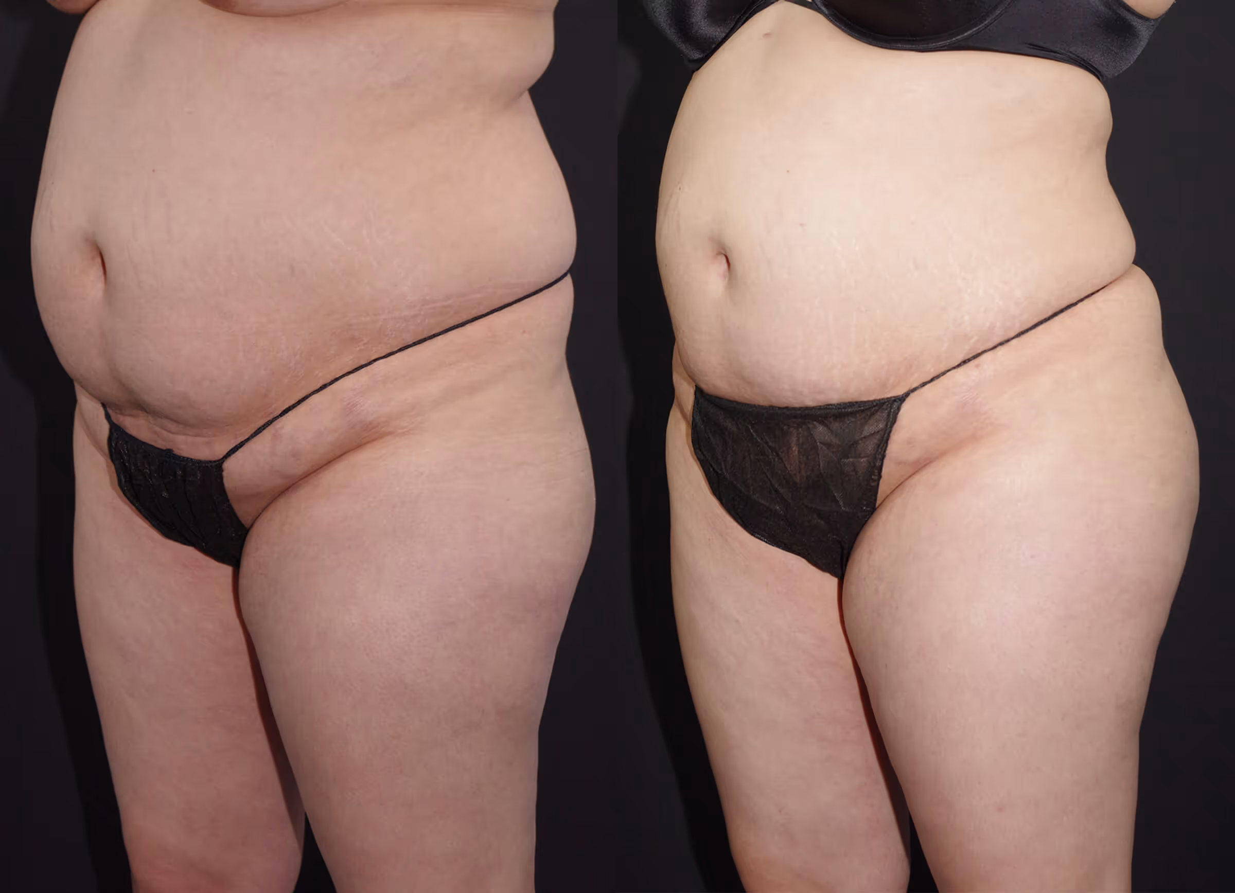 Before And After Patient Image