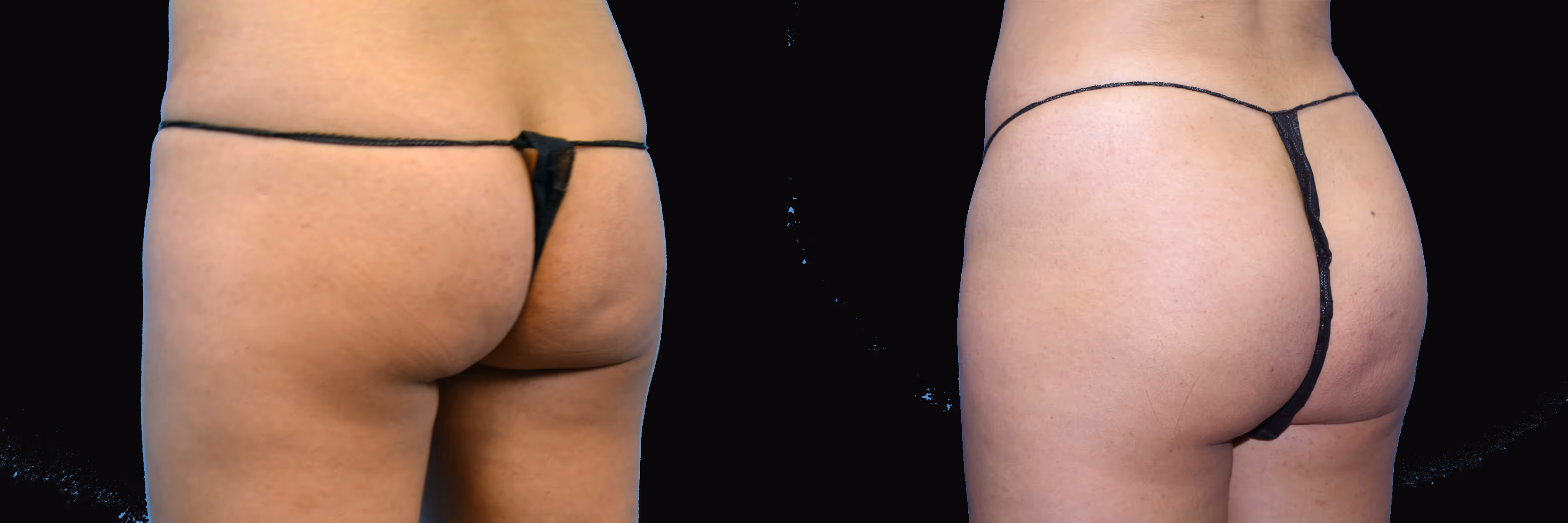 Before And After Patient Image