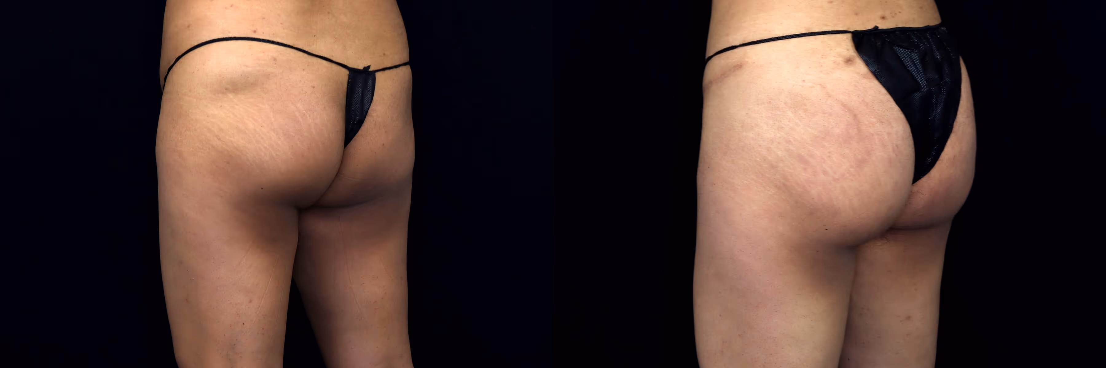 Before And After Patient Image