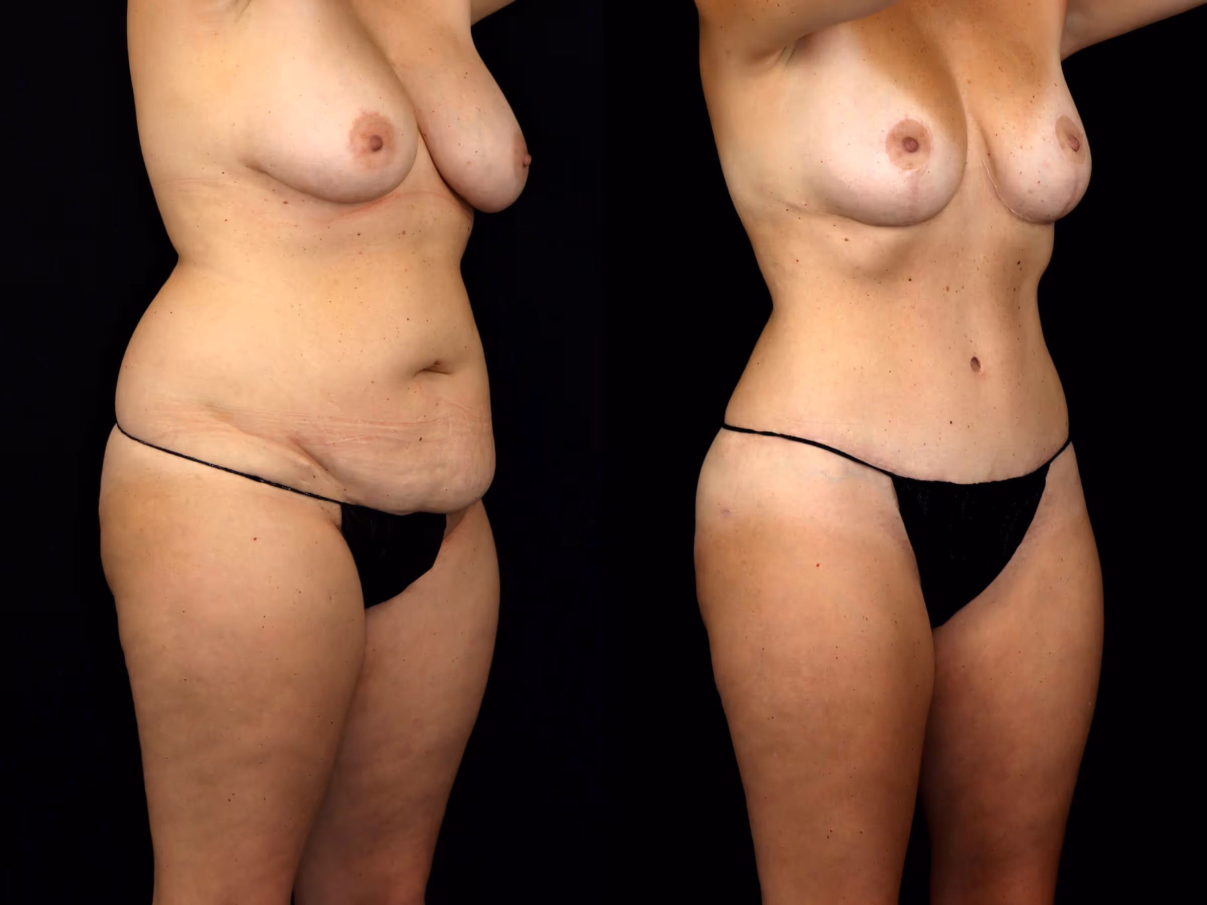 Before And After Patient Image