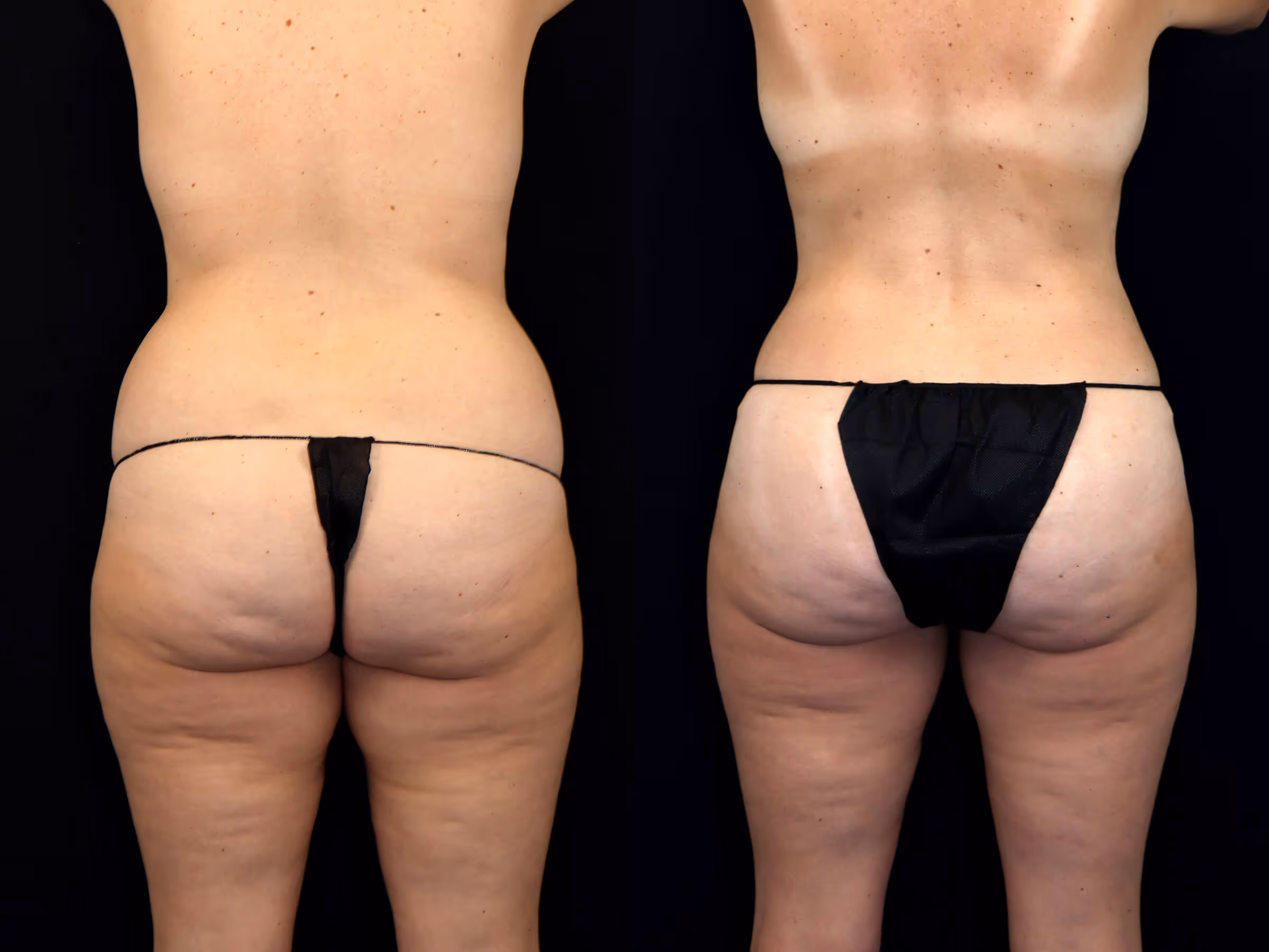 Before And After Patient Image