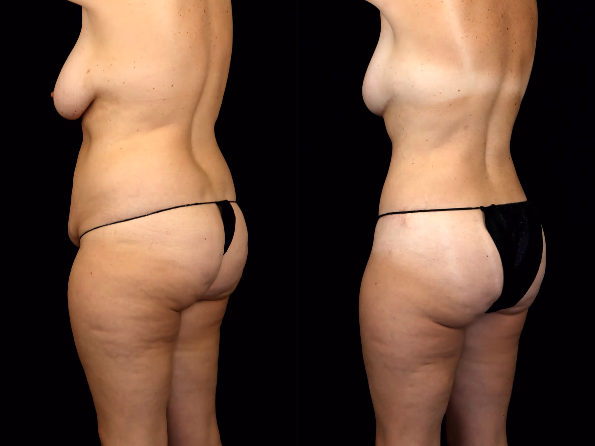 Before And After Patient Image
