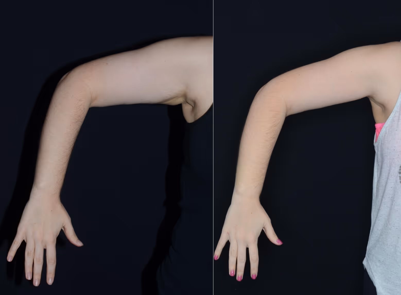 Before And After Patient Image