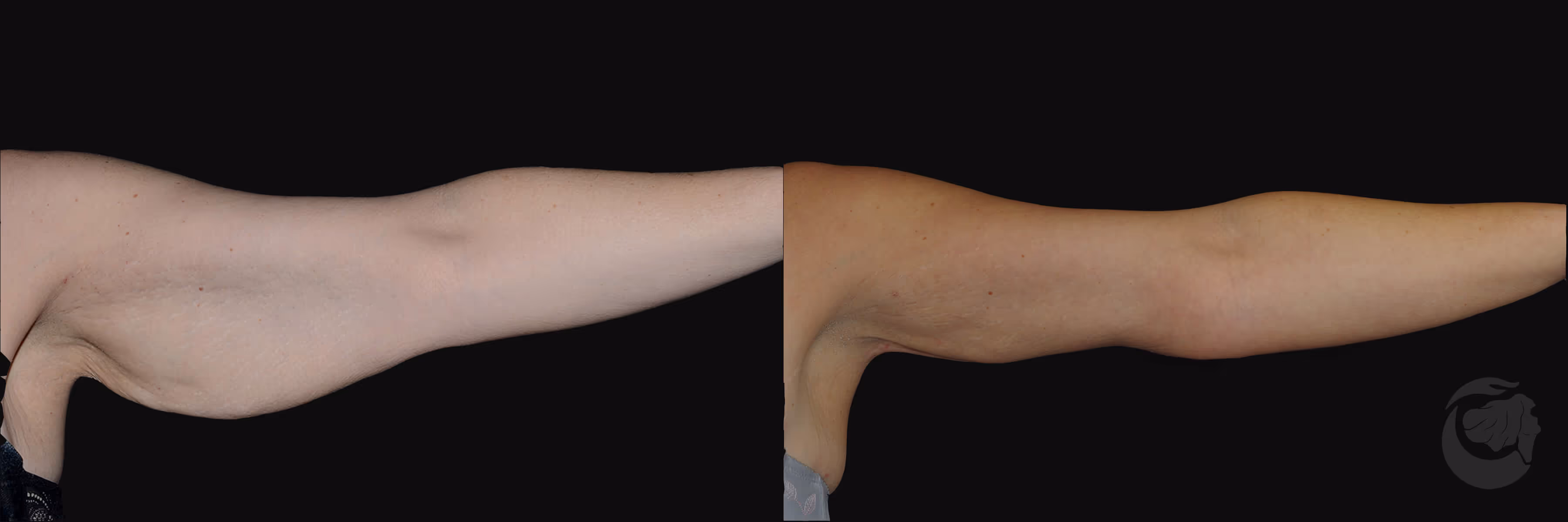 Before And After Patient Image