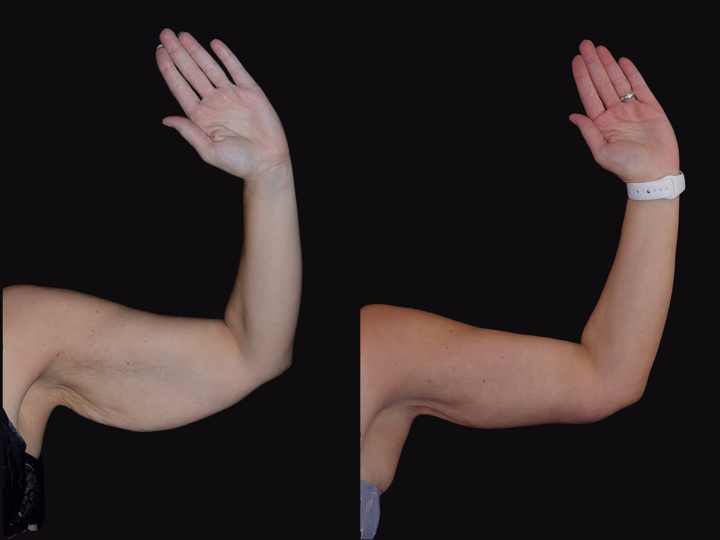 Before And After Patient Image
