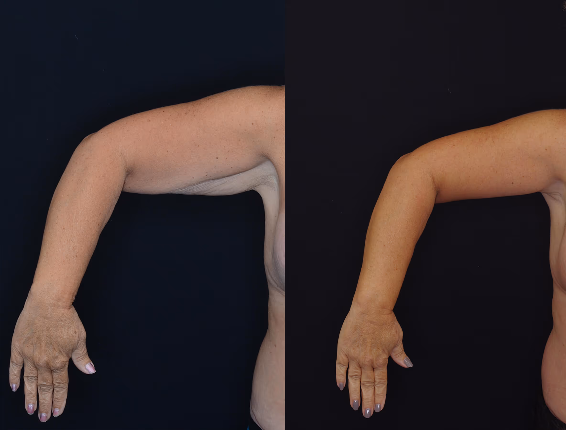 Before And After Patient Image