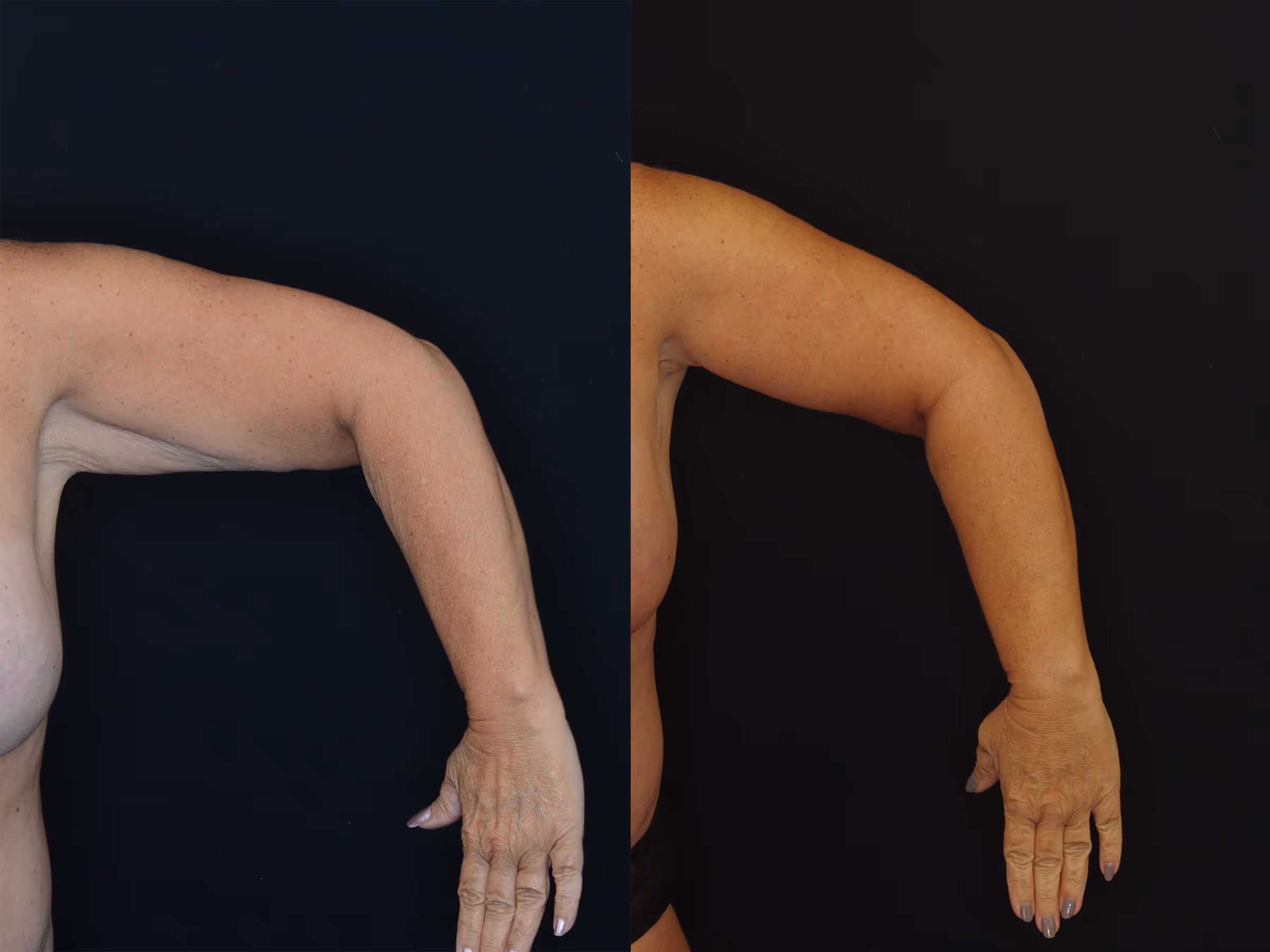 Before And After Patient Image
