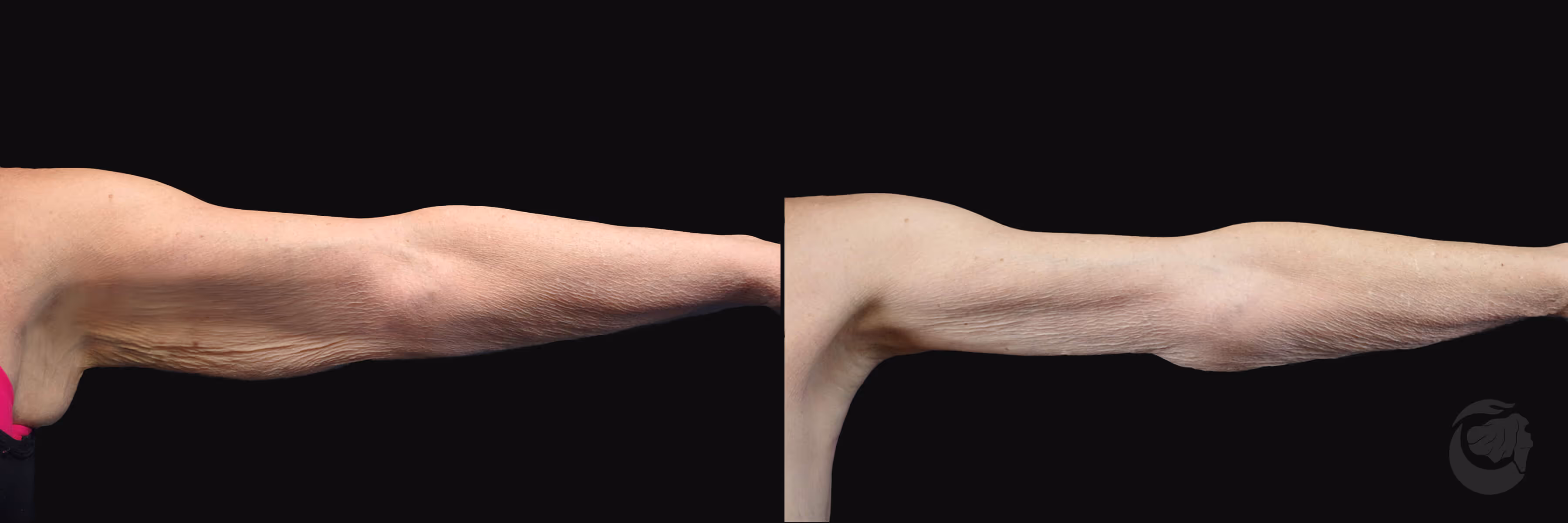 Before And After Patient Image