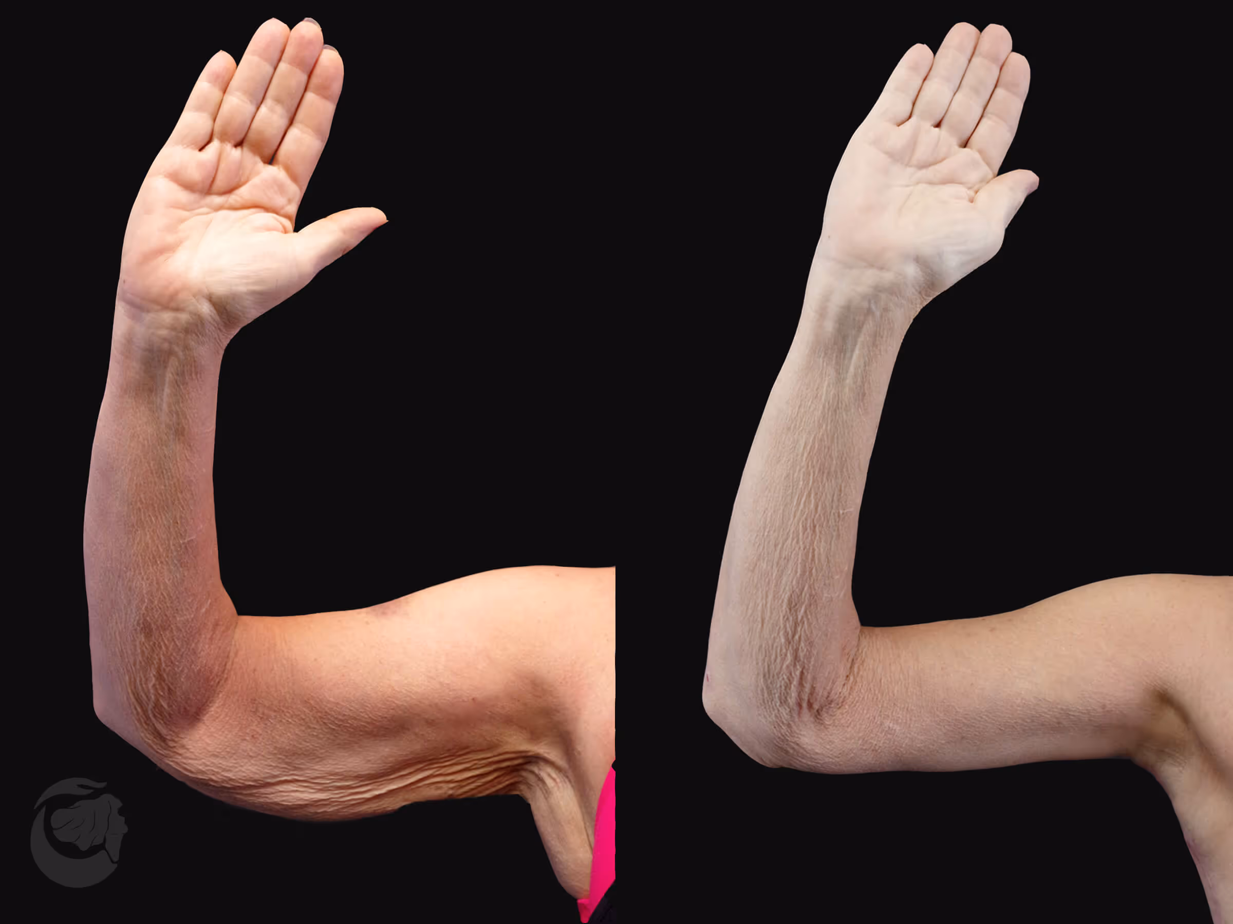 Before And After Patient Image