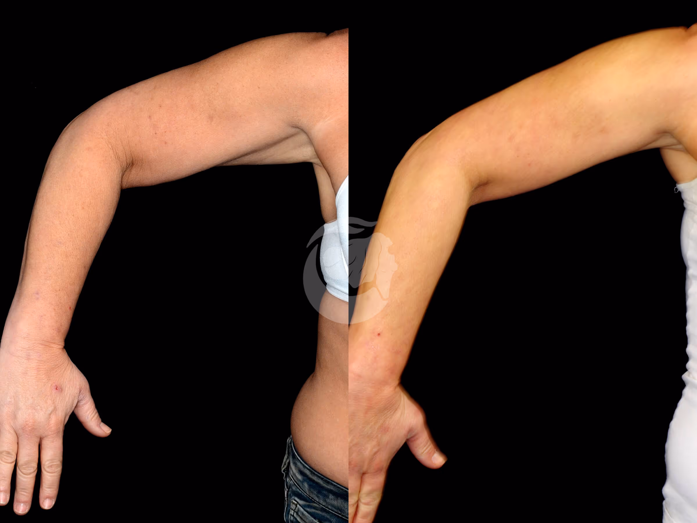Before And After Patient Image