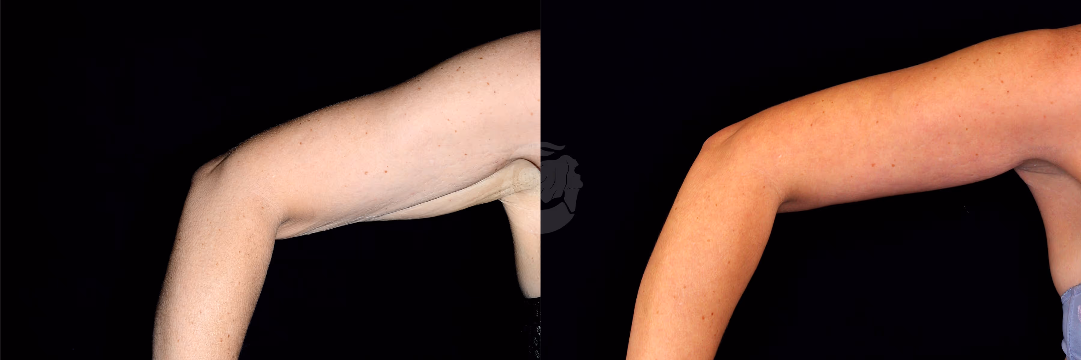 Before And After Patient Image