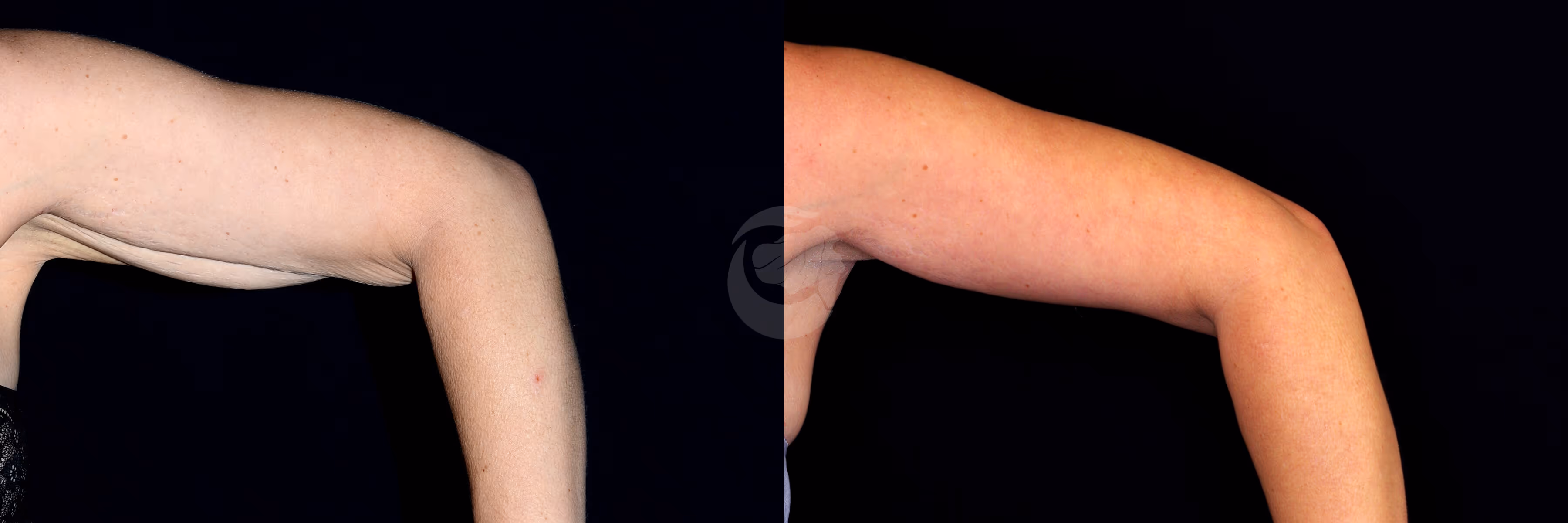 Before And After Patient Image