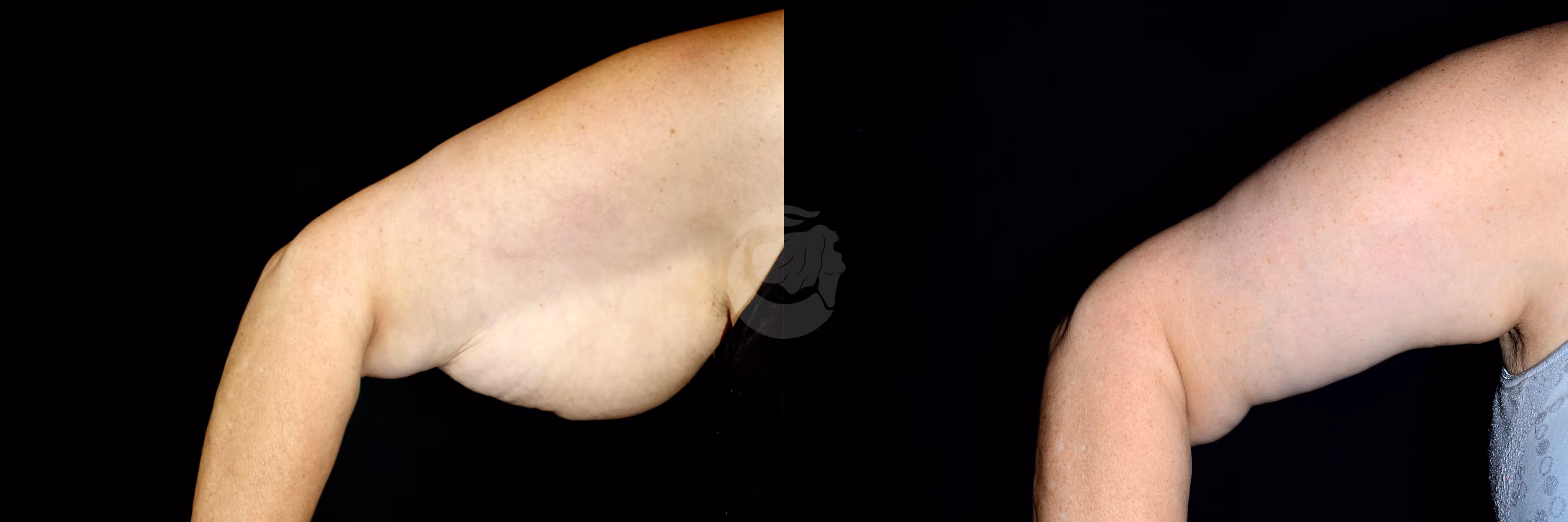 Before And After Patient Image