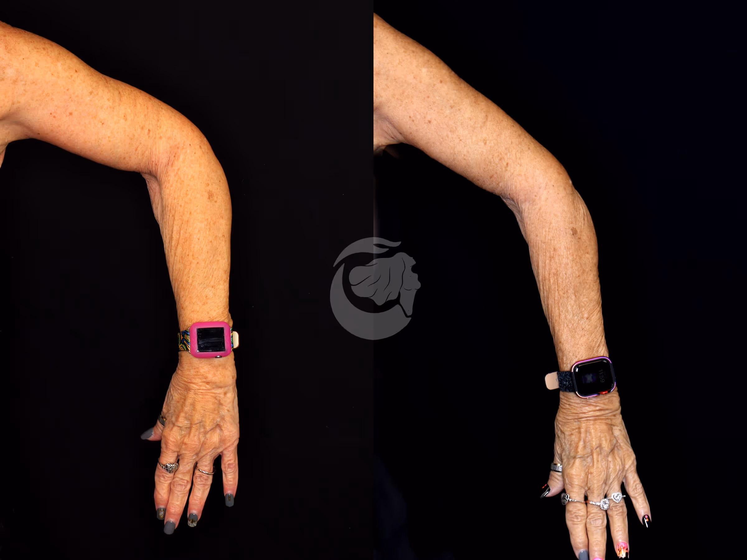 Before And After Patient Image
