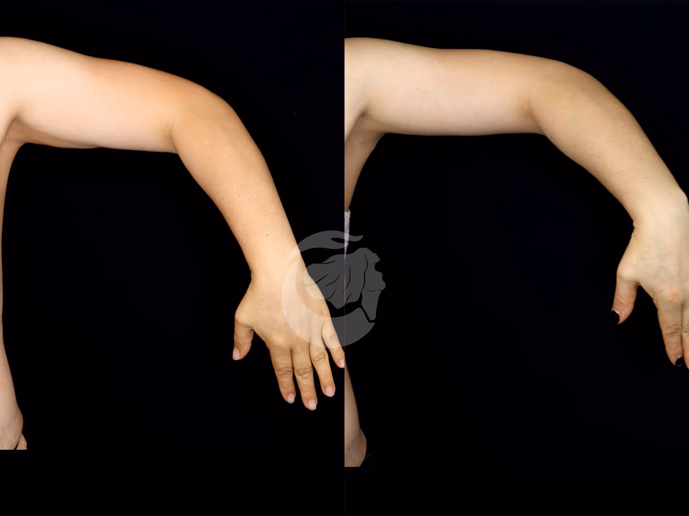 Before And After Patient Image