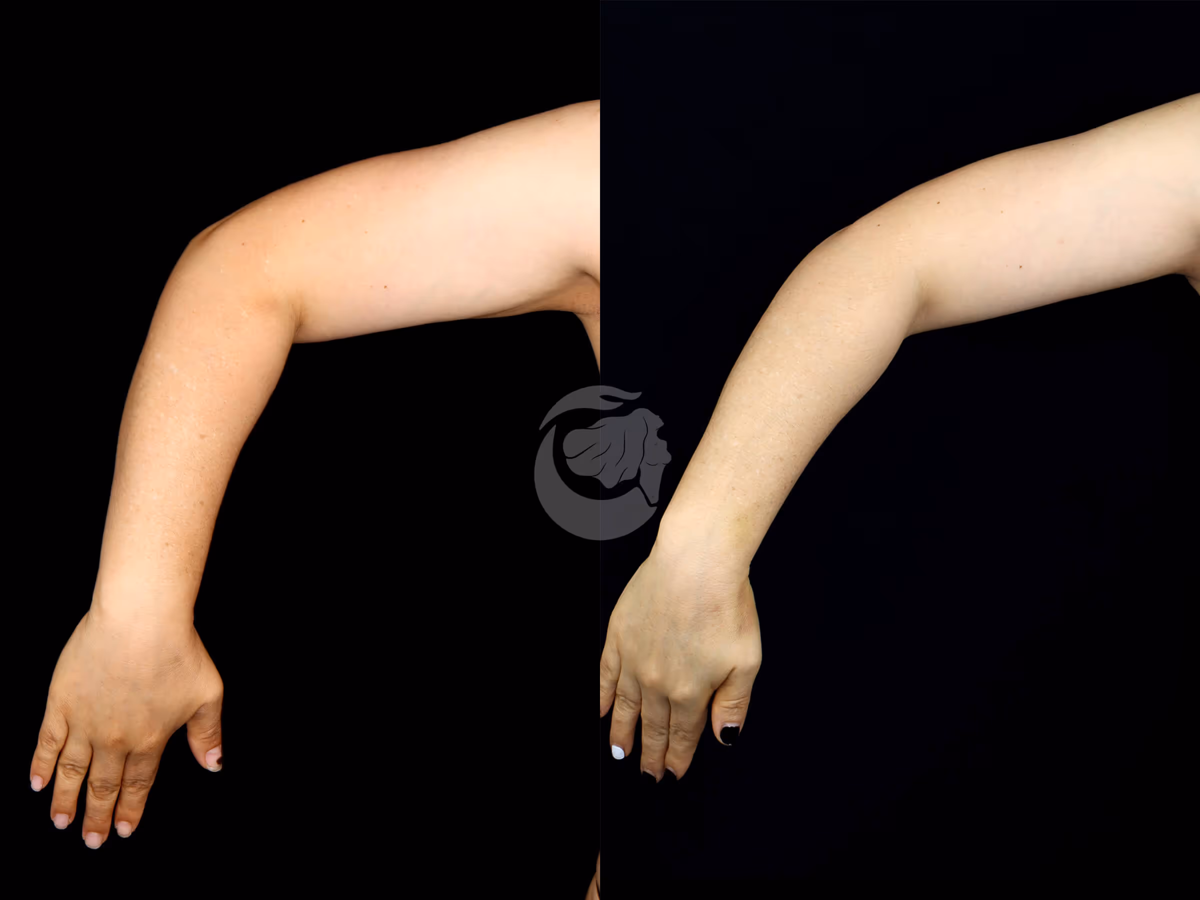 Before And After Patient Image