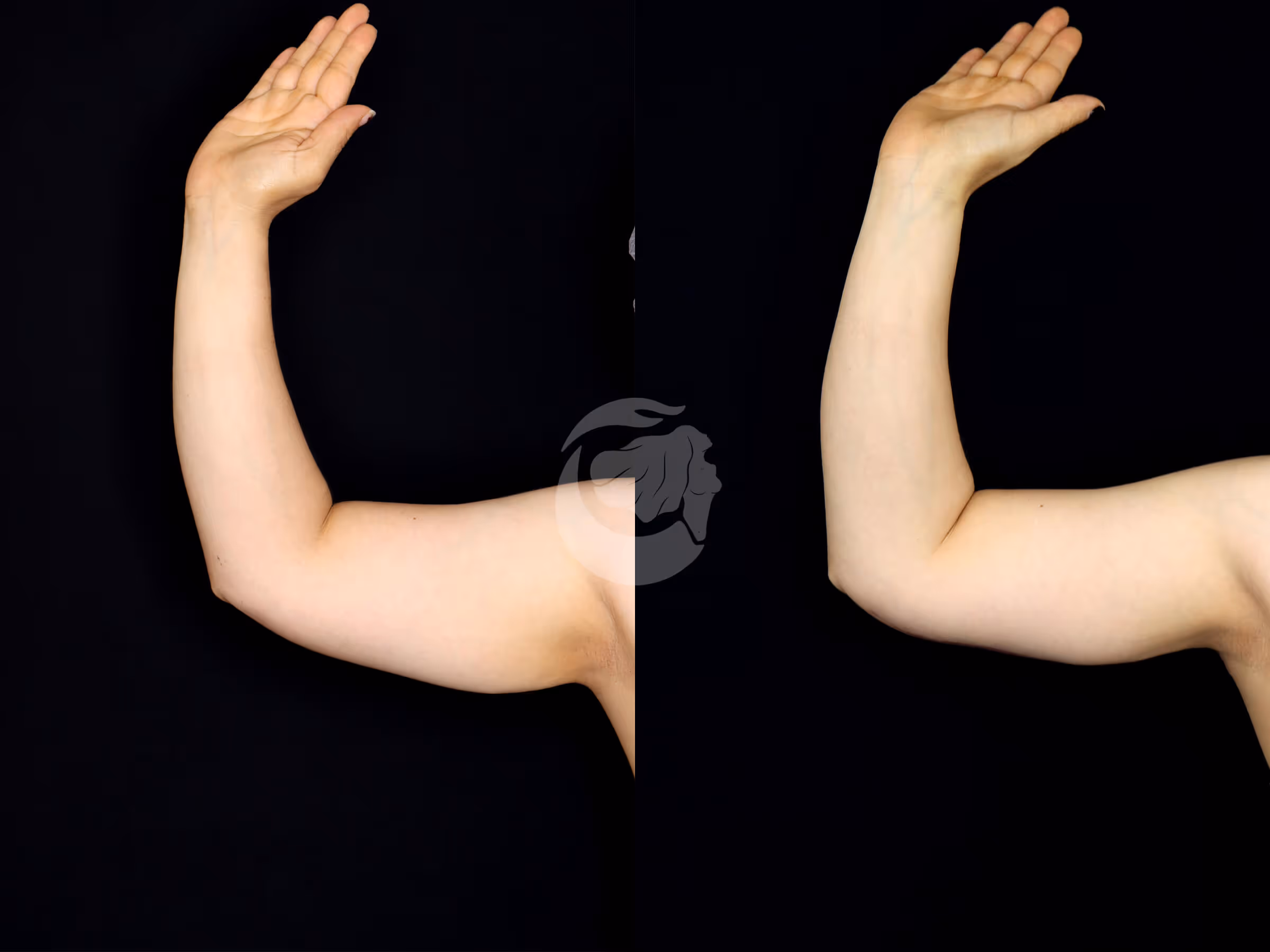 Before And After Patient Image