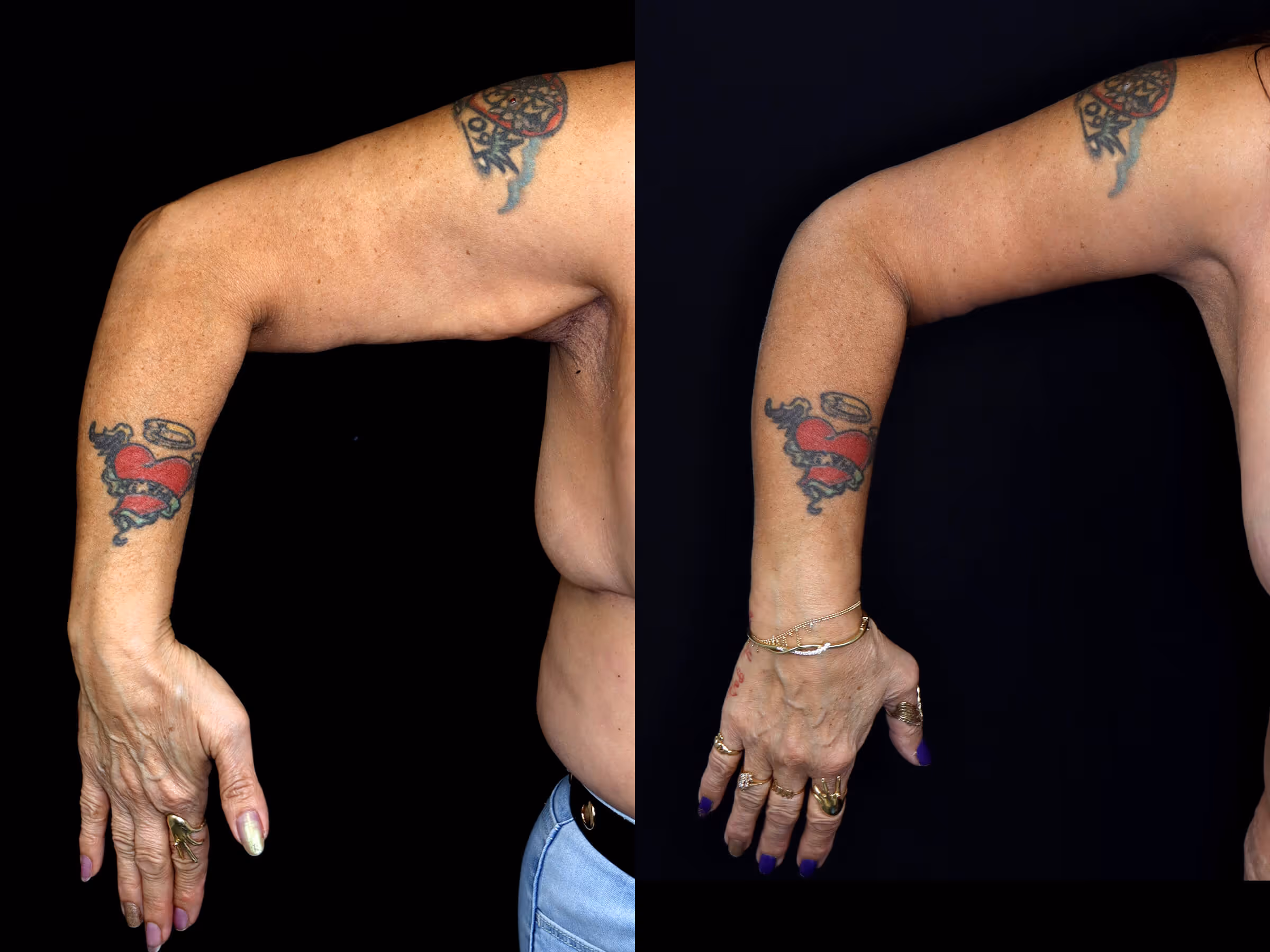 Before And After Patient Image
