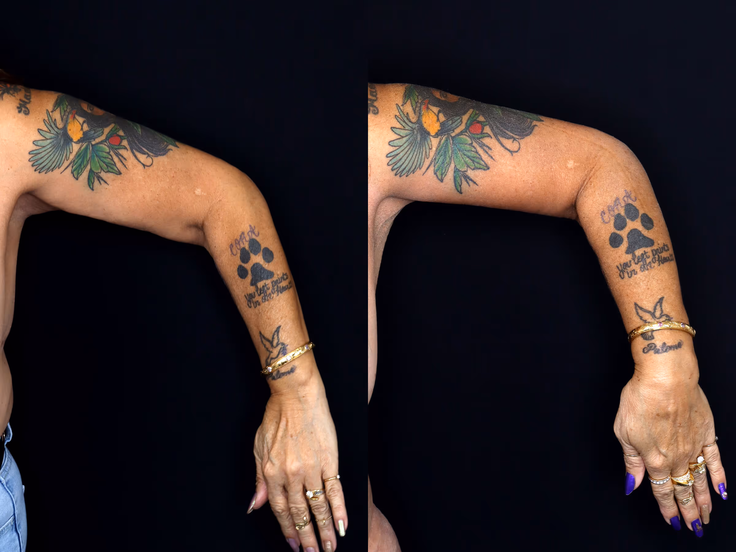 Before And After Patient Image
