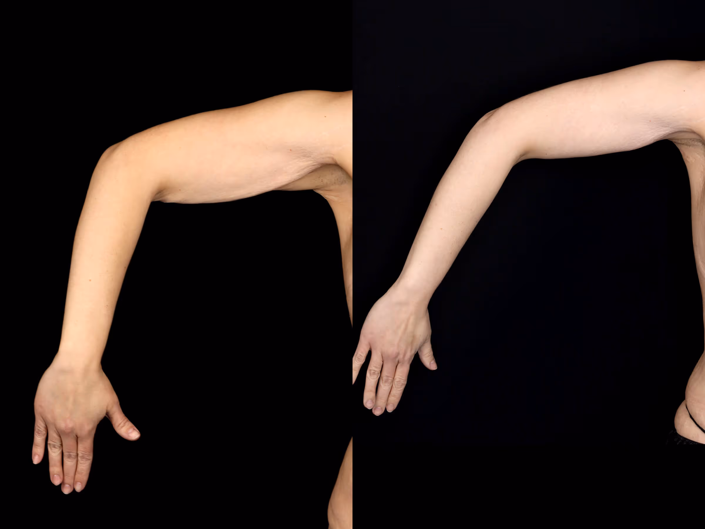Before And After Patient Image
