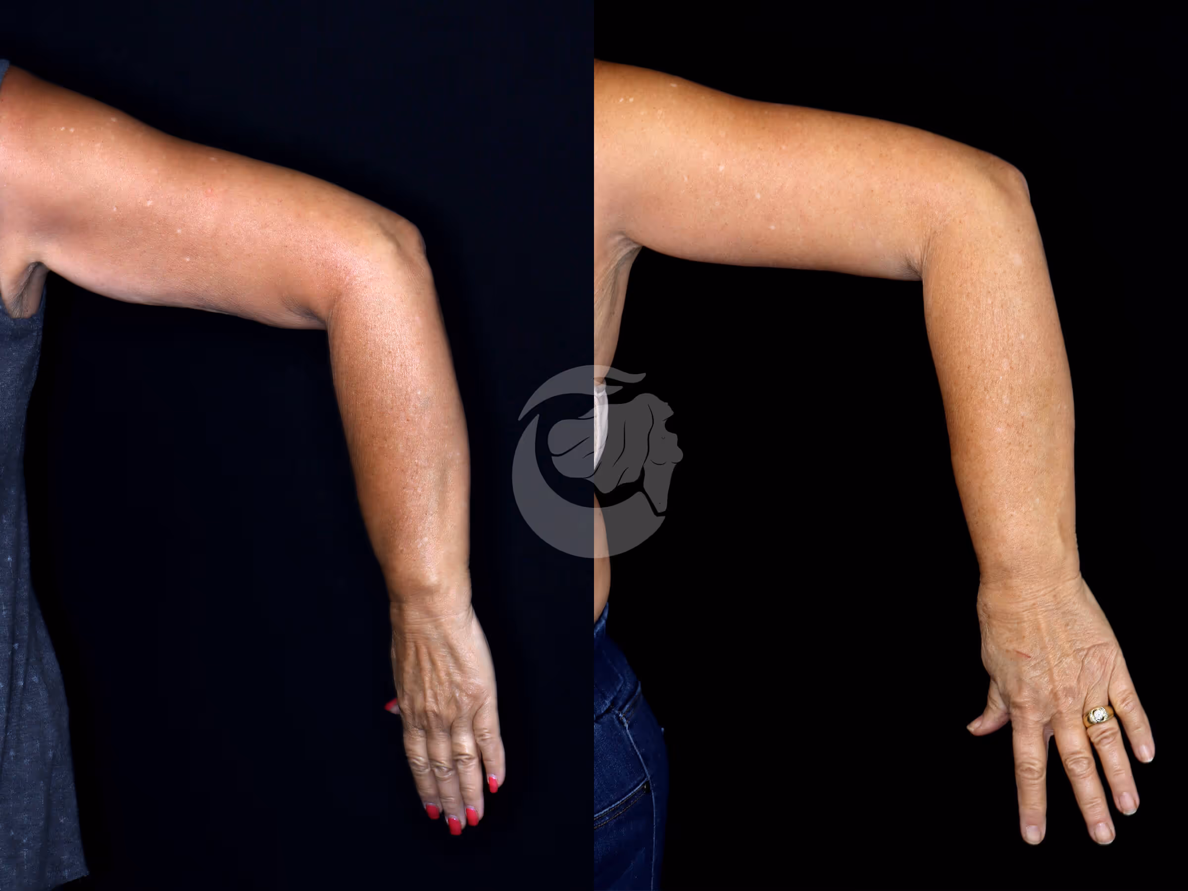 Before And After Patient Image