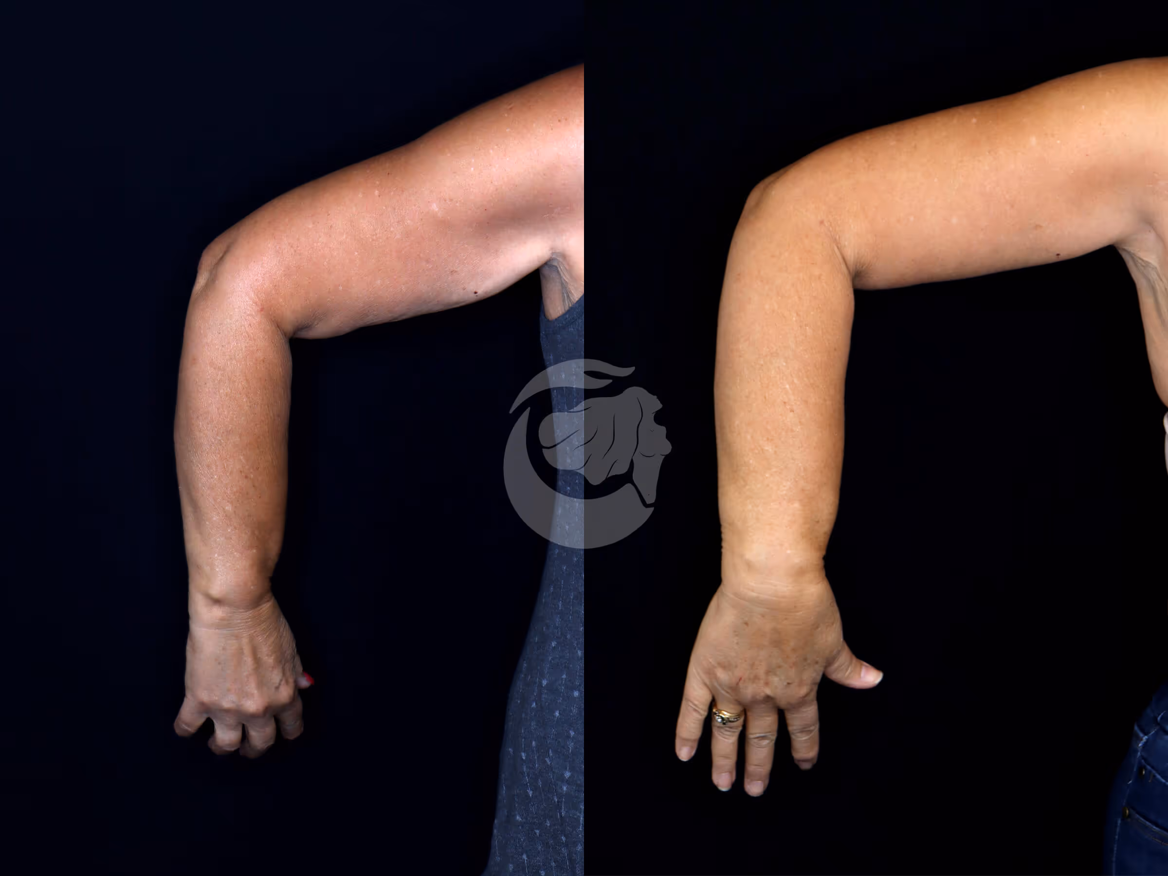 Before And After Patient Image